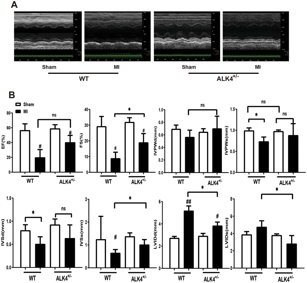 ALK4 haplodeficiency ameliorates MI-induced cardiac dysfunction. (A) M-mode echocardiograms obtained on the 3rd day post-MI. (B) Quantitative analysis of %EF, %FS, IVPW, IVS and LVID in both mice (n > 4 for each). *P 