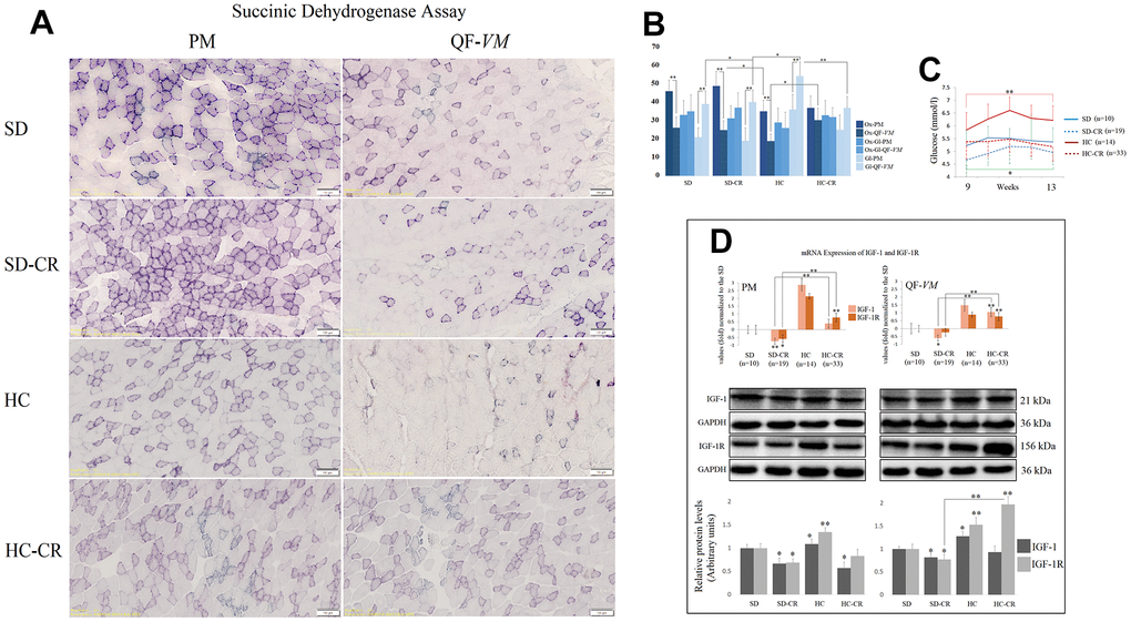 Metabolic characterization of PM and QF-VM in the experimental animal model. Representative images of SDH staining in muscle fibers of PM and QF-VM in the different groups (A). Scale bar: 100 μm. SD (n=6), SD-CR (n=8), HCD (n=9), and HCD-CR (n=12). The total area stained with Oil red O (B). Dark stained fibers were classified as oxidative (Ox); intermediate stained fibers were classified as oxidative-glycolytic (Ox-Gl); and very lightly or non-stained fibers were classified as glycolytic (Gl). Comparison of the blood glucose levels of mice during week 9 to 13 of the dietary restriction (C). IGF-1 and IGF-1R were analyzed by qPCR and Western Blot analysis (D). mRNA was expressed as fold, the SD value was set to 0, and the compared samples were normalized to this level. Positive values represent upregulation. Negative values represent downregulation. Protein expression of IGF-1 and IGF-1R was obtained by Western Blot analysis and quantified with Image Lab 6.1 software. SD expression was set to 1 and the relative protein levels were normalized as a ratio of GAPDH expression. The data are the mean ± s.d. *P 