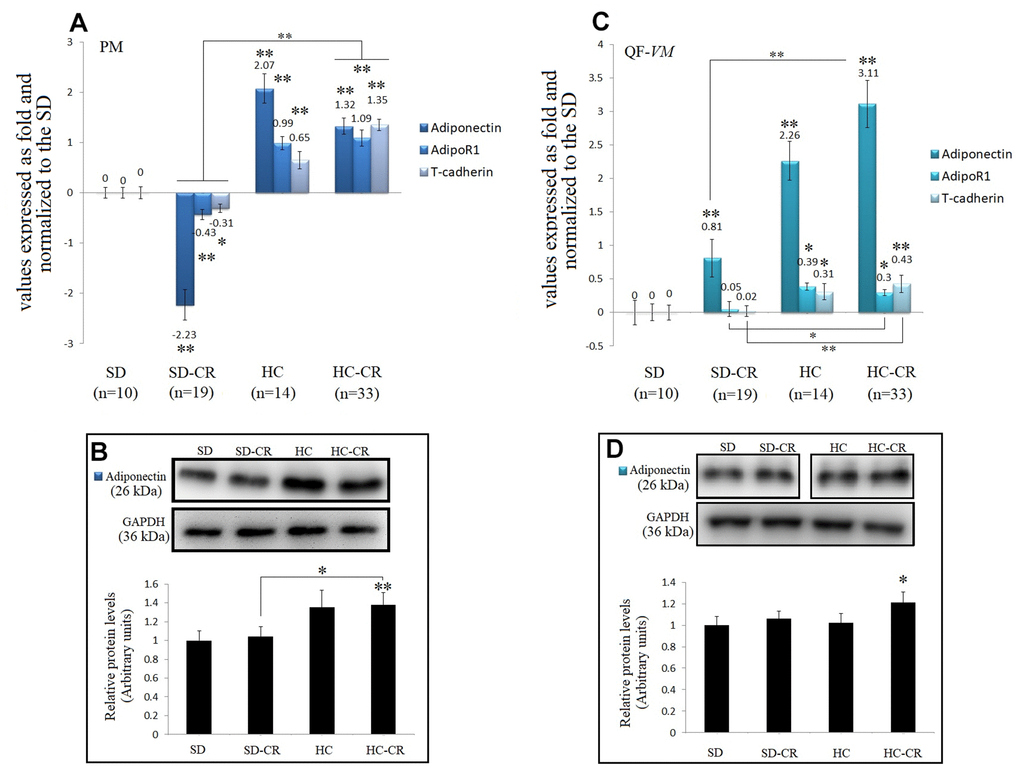 Expression of Adiponectin and Adiponectin-receptors. The mRNA levels of adiponectin, AdipoR1, and T-cadherin in pectoralis major (PM) (A). Immunoblot results and protein expression of adiponectin in PM (B). mRNA levels of adiponectin, AdipoR1, and T-cadherin in quadriceps femoris vastus medialis (QF-VM) (C). Immunoblot results and protein expression of adiponectin in QF-VM (D). Adiponectin, AdipoR1, T-cadherin, and 18s rRNA (reference gene) transcripts were analyzed by qPCR. Significant differences between groups are expressed as fold change values. For each gene expressed as a fold change, the SD value was set to 0, and the compared samples were normalized to this level. Positive values represent upregulation. Negative values represent downregulation. The fold changes are defined directly in terms of ratios. Each marker was analyzed with SYBR Green fluorescence detection, and the transcript levels were normalized to those of the endogenous control 18s rRNA. Protein expression of adiponectin in PM and QF-VM was obtained by Western Blot analysis and quantified with Image Lab 6.1 software. SD expression was set to 1 and the relative protein levels were normalized as a ratio of GAPDH expression. The data are the mean ± s.d. *P 