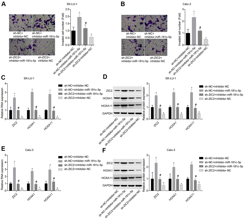 Knockdown of miR-181c-5p inhibited LUAD cell invasion by targeting ZIC2. (A, B) Transwell chambers were applied for cell invasion assessment. (C, E) The mRNA levels of ZIC2, HOXA1 and HOXA11 were detected by RT-PCR technology. (D, F) The protein levels of ZIC2, HOXA1 and HOXA11 were measured by western blotting technology. (*p0.05, vs. sh-NC + inhibitor-NC group; #p0.05, vs. sh-NC + inhibitor-miR-181c-5p group).