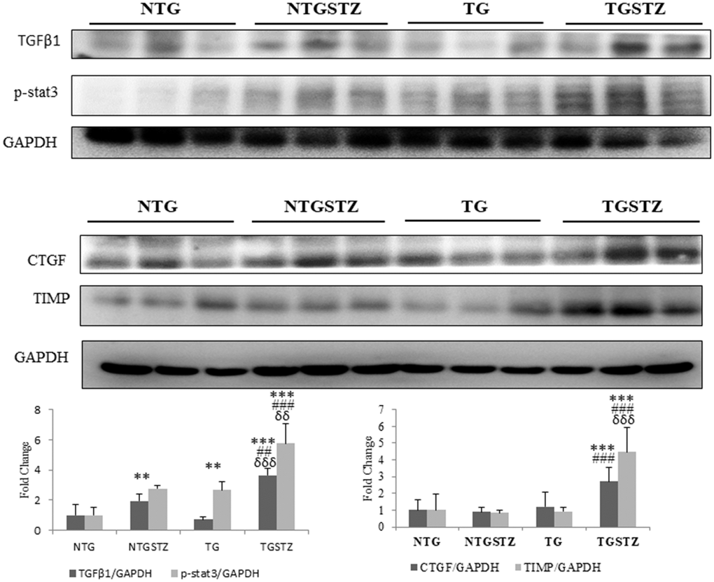 Changes in diabetic nephropathy associated Inflammation mediators. Western blotting analysis (n=3) on DM associated inflammatory cytokines showed differences in the levels of TGFβ1, p-stat3, CTGF and TIMP that are associated with fibrosis in kidney, among Non-transgenic rats (NTG), transgenic (TG), NTG-streptozotocin induced diabetes model (NTGSTZ), TG streptozotocin induced diabetes model (TGSTZ). **p0.01 and *** pp0.01 and ### pp0.01 and δδδ p