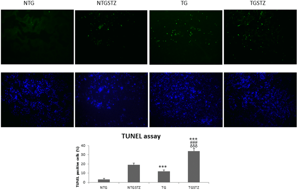 Effects of cardiac specific IGFIIRα overexpressing DM rats on apoptosis. STZ induced DM rats show TUNEL positive nuclei (green). IGF2R overexpression in hearts increases the apoptosis rate in kidney (n=3). Scale bar represent 100 μm at 40 x magnification. *** ppp