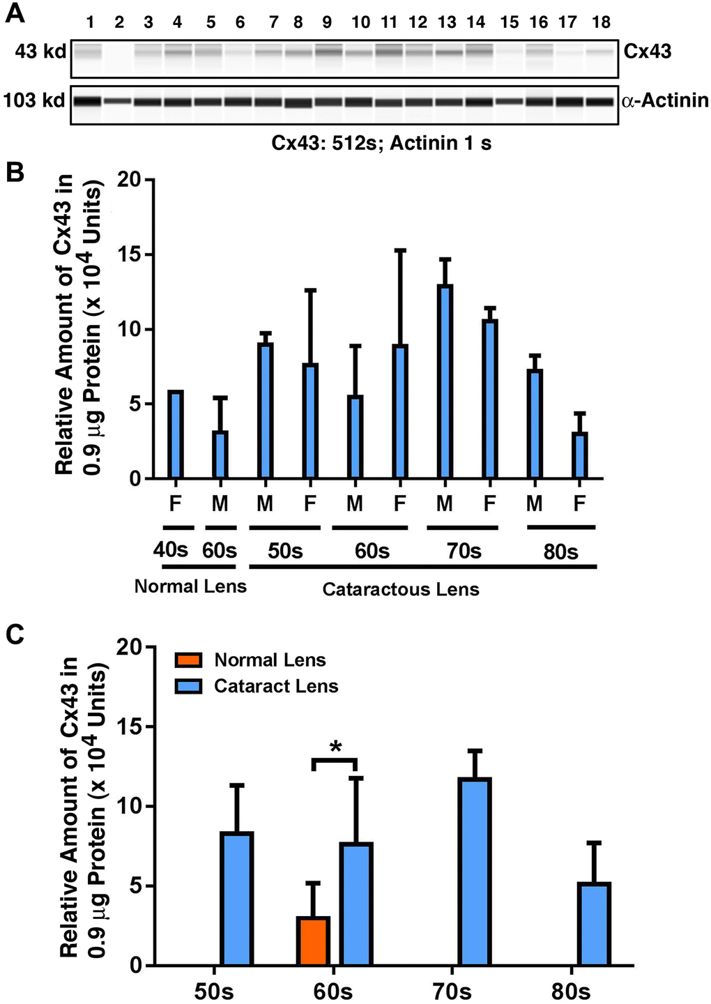 The automated western immunoblot (AWI) analyses of connexin 43 (Cx43) in human normal and cataractous lenses of different age groups. AWI was performed on a Wes (ProteinSimple) as described recently [48, 56]. Briefly, each sample was loaded with 0.9 μg total protein and then analyzed with the Size Separation Master Kit and Split Buffer (12–230 kDa) according to the manufacturer’s standard instruction using anti-Cx43 antibody (for antibody information, see Experimental Procedures) with a dilution factor of 1:100. The Campass software (Protein Simple, version 4.1.5) was used to program the PeggySue-robot and for presentation (A) and quantification (B–C). Output western blot style data (A) were displayed with exposure time indicated, and the quantification data (B–C) were displayed from the software-calculated average of seven exposures (1–512s). (B) Quantification results show gender difference. Each bar represents an average of 8 samples for cataract lenses but one sample for normal human lens of 40s and three samples for normal human lenses of 60s. Lanes 1–2 represent normal lenses, and lanes 3–18 represent cataractous lenses of different age groups (3–6, 50s; 7–10, 60s; 11–14, 70s and 15–18, 80s). (C) Quantification results show age difference. *p 