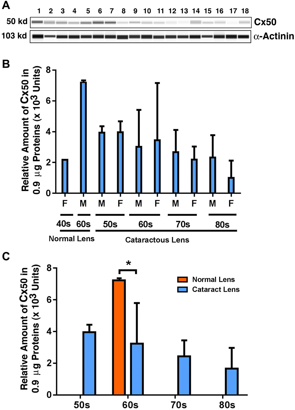 The automated western immunoblot (AWI) analyses of connexin 50 (Cx50) in normal and cataractous lenses of different age groups. AWI was performed on a Wes (ProteinSimple) as described recently [48, 56]. Briefly, each sample was loaded with 0.9 μg total protein and then analyzed with the Size Separation Master Kit and Split Buffer (12–230 kDa) according to the manufacturer’s standard instruction using anti-Cx50 antibody (for antibody information, see Experimental Procedures) with a dilution factor of 1:20. The Campass software (Protein Simple, version 4.1.5) was used to program the PeggySue-robot and for presentation (A) and quantification (B–C). Output western blot style data (A) were displayed with exposure time indicated in Figure 1, and the quantification data (B–C) were displayed from the software-calculated average of seven exposures (1–512s). (B) Quantification results show gender difference. Each bar represents an average of 8 samples for cataract lenses but one sample for normal human lens of 40s and three samples for normal human lenses of 60s. Lanes 1–2 represent normal lenses, and lanes 3–18 represent cataractous lenses of different age groups (3–6, 50s; 7–10, 60s; 11–14, 70s and 15–18, 80s). (C) Quantification results show age difference. *p 