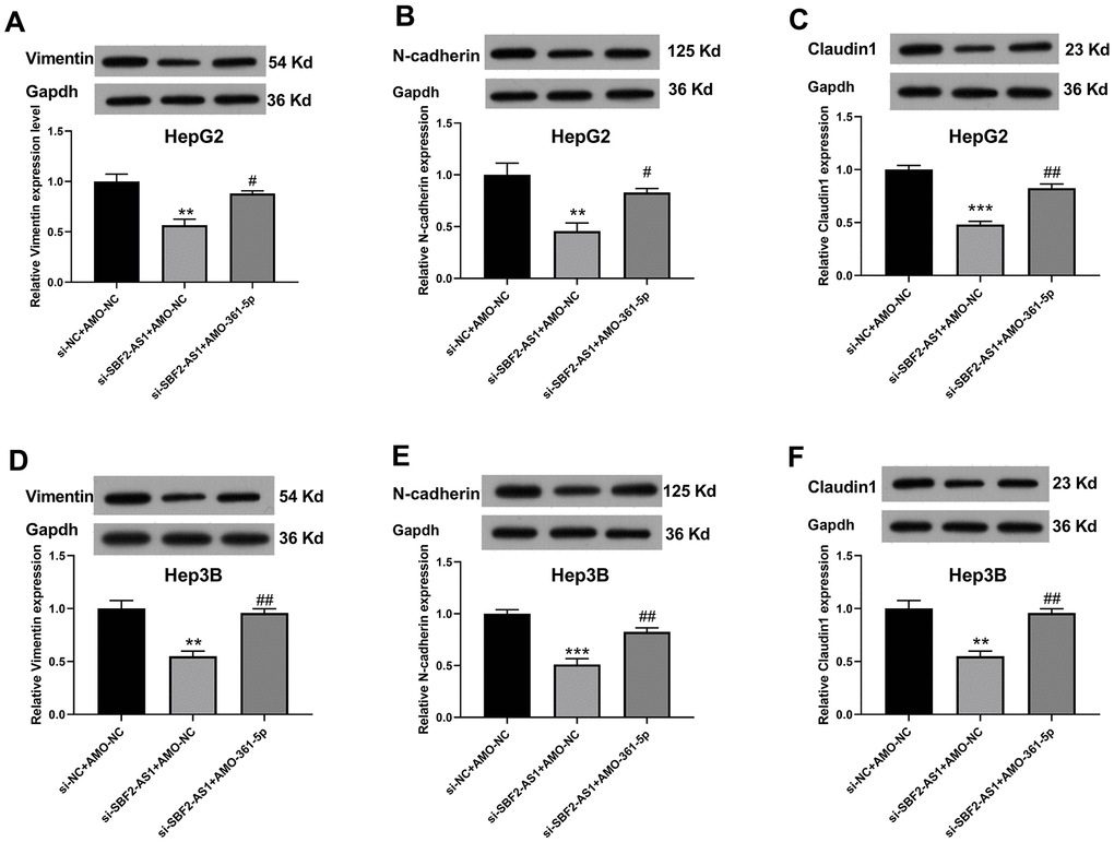 Suppression of miR-361-5p attenuates the influence of lncRNA SBF2-AS1 downregulation on vimentin, E-cadherin, and claudin-1 protein expression in HCC cells. (A–C) The protein expression of Vimentin (A), E-cadherin (B), and Claudin-1 (C) in HepG2 cells. (D–F) The protein expression of Vimentin (D), E-cadherin (E), and Claudin-1 (F) in Hep3B cells. The data are expressed as mean ± SEM. ** P 