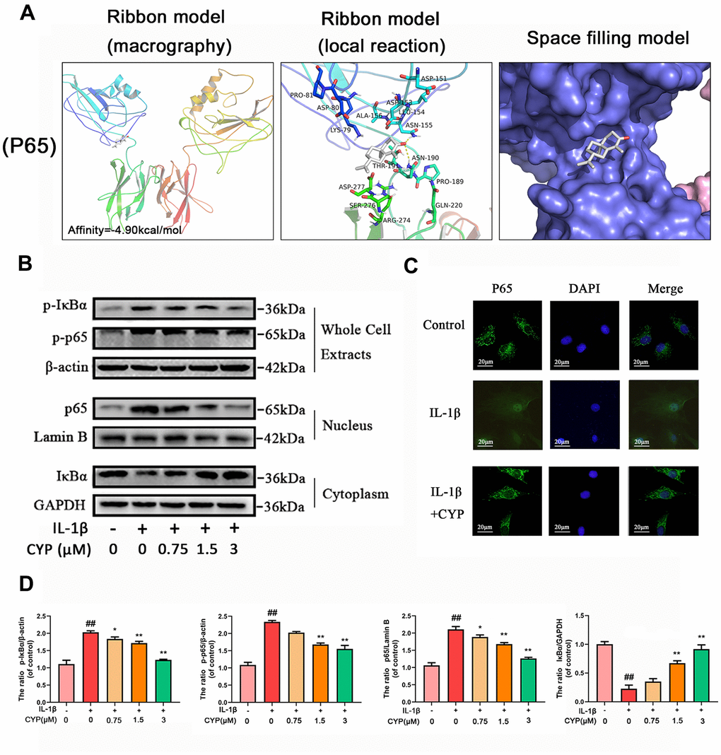 Effect of CYP on NF-κb activation induced by IL-1β (10 ng/ml). (A) Molecular docking results of CYP with p65 revealed that CYP was embedded in the binding pockets of proteins. Hydrogen bonds were built between CYP and ASN-155 and ASN-190. Expression levels of p-IκBα and p-p65 in whole chondrocyte extracts, p65 in nucleus and IκBα in cytoplasm were detected by western blot assay (B) and quantified by Image Lab software (D). (C) Nuclear translocation of p65 was detected through immunofluorescence combined with DAPI staining for nuclei (scale bar: 20 μM). Data presented are means ± S.D. ## means p vs. the control group and ** p p vs. the IL-1β alone group, n=5.