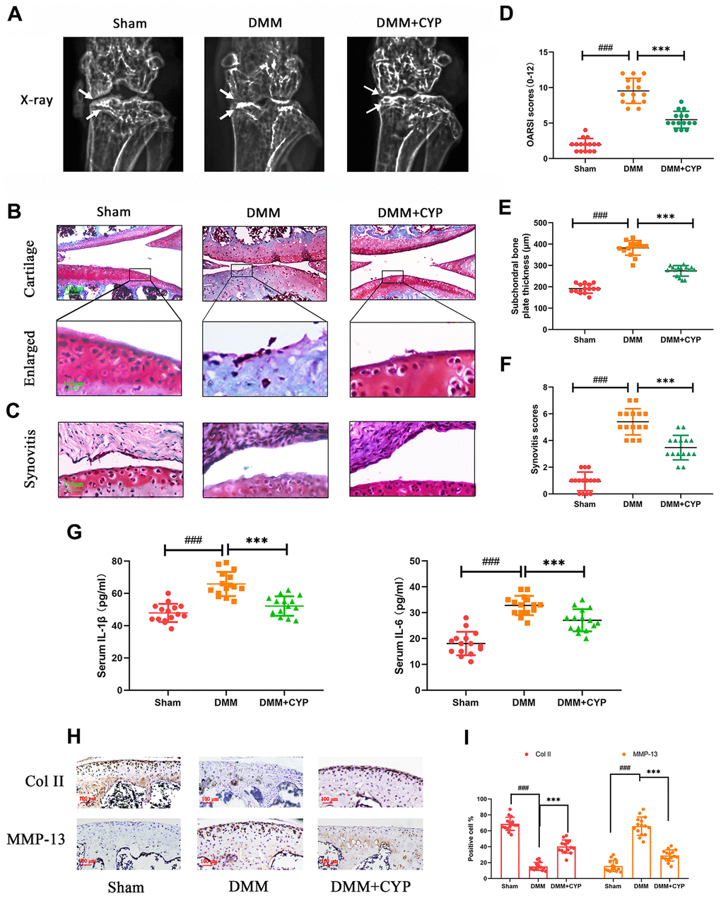 CYP ameliorates knee joint degradation of OA in a surgery-induced mouse DMM model in vivo. (A) Digital X-ray images showing the degree of degradation in the mouse knee joint across the three experimental groups. White arrows indicate the narrow space of joint and the formation of abnormal osteophyte. (B, C) Representative safranin O-fast green (S-O) staining of the cartilage and synovitis across the three experimental groups (scale bar: 200 μm in cartilage and 100 μm in enlarged). (D) OARSI scores of the cartilage across the three experimental groups. (E) Thickness of the subchondral bone plate across the three experimental groups. (F) Synovitis scores in the three experimental groups. (G) The amount of IL-1β and IL-6β in joint serum was detected by ELISA test. (H) Immunohistochemical staining of collagen II and MMP-13 expression in the cartilage samples (scale bar: 100 μm). (I) The percentages of collagen II and MMP-13 positive cells in each section were quantified by Image Pro Plus. Data are presented as means ± S.D. ### denotes p