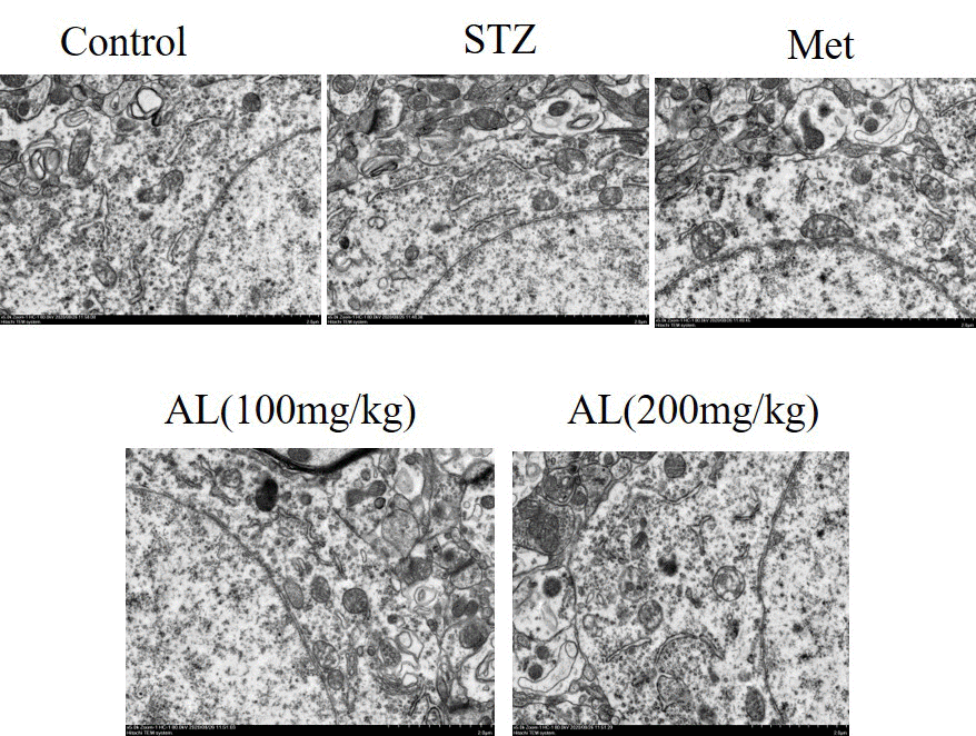 Observation of hippocampus by transmission electron microscope (x400).