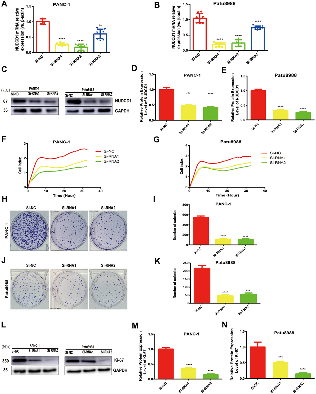 NUDCD1 knockdown inhibited the proliferation of PC cells. (A, B) The interference effects of three siRNAs on NUDCD1 were confirmed by qRT-PCR. (C–G) NUDCD1 knockdown inhibited the proliferation of PANC-1 and Patu8988 cells. (H–K) NUDCD1 knockdown inhibited the colony formation of Patu8988 and PANC-1 cells. (L–N) Western blot analysis showed that NUDCD1 knockdown decreased the expression of Ki-67 in PANC-1 and Patu8988 cells.**p