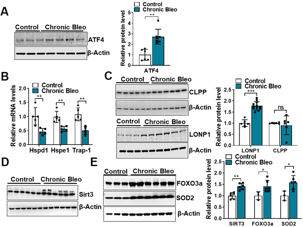 7-day bleomycin protocol activates the mitochondria unfolded protein response and induces expression of mitochondrial chaperones in alveolar epithelial cells. (A) WB for ATF4 in controls vs. chronically injured lung epithelial cells (with β-actin loading control). Densitometry is shown on the right. (B) Transcript levels for Hsp60, Hsp10 and Hps90 in controls vs. chronically injured MLE12 cells. (C) WB for Clpp and Lonp1 in control and bleomycin injured cells (with β-actin loading control). Densitometry is shown on the right. (D, E) WB for SIRT3, FOXO3a and SOD2 in control and bleomycin injured MLE12 cells (with β-actin loading control). Densitometry is shown on the right. Statistical significance was assessed by unpaired Student’s t-test for two groups. * p