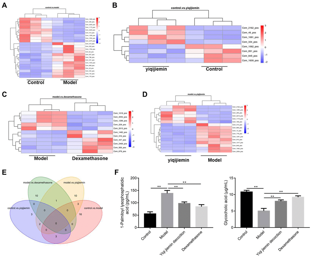 YJD treatment reverses serum metabolite changes in the AR model guinea pigs. (A–D) Heat map shows clustering of various metabolites as analyzed by LC-HRMS in the control vs. AR model, AR model plus YJD vs. control, AR model vs. AR model plus dexamethasone, and AR model vs. AR model plus YJD groups. (E) Venn diagram shows the common metabolites that are differentially expressed when comparing control vs. AR model, AR model plus YJD vs. control, AR model vs. AR model plus dexamethasone, and AR model vs. AR model plus YJD groups. (F) ELISA assay results show the levels of LPA and GCA metabolites in the serum of control, AR model, AR model plus YJD, and AR model plus dexamethasone groups.