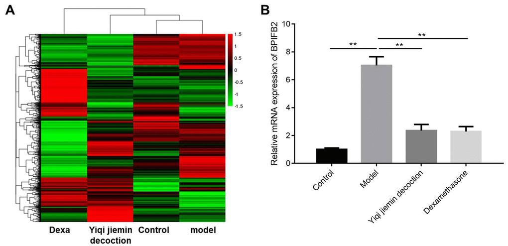 Identification of differentially expressed genes (DEGs) in the nasal mucosal tissues of AR model guinea pigs treated with YJD or dexamethasone. (A) Heat map shows differentially expressed genes (DEGs) in the nasal mucosal samples from the control, AR model, AR model plus YJD, and AR model plus dexamethasone groups. The color code (green to red) denotes the relative expression levels of the DEGs (high or low). (B) QRT-PCR analysis shows BPIFB2 mRNA levels in the nasal mucosal samples from the control, AR model, AR model plus YJD, and AR model plus dexamethasone groups. *P 