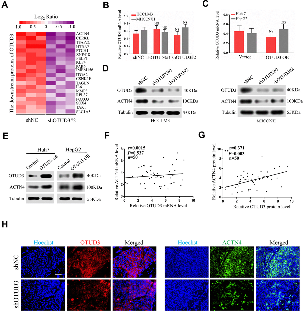 ACTN4 protein level is significantly correlated with OTUD3 expression in HCC. (A) Mass spectroscopic analysis listed the top 20 downregulated proteins with OTUD3 knockdown in HCCLM3 cells. (B) qRT-PCR analyses were used to detect ACTN4 mRNA levels in OTUD3 knockdown HCCLM3 and MHCC97H cells compared with the control group. (C) qRT-PCR analysis evaluating ACTN4 mRNA levels in OTUD3 upregulation Huh7 and HepG2 cells compared with the control group. (D) Western blot detecting ACTN4 protein expression in OTUD3 knockdown and the control HCCLM3 and MHCC97H cells. (E) Western blot showing ACTN4 protein expression in OTUD3 overexpression and the control Huh7 and HepG2 cells. (F) Scatter plots showed no significant correlations between OTUD3 and ACTN4 at the mRNA levels in 50 HCC tissues. (G) Scatter plots showed positive correlations between OTUD3 and ACTN4 at the protein levels in 50 HCC tissues. (H) Immunofluorescence staining of ACTN4 and OTUD3 in subcutaneously tumour of nude mice injected with HCCLM3 cells stably transfected shOTUD3 or shNC (n=6 per group; scale bar: 100μm; Magnification: 200X). The unpaired two-sided Student’s t test was used for comparing between two groups of equal variances. Error bars represent mean ± SD from three independent experiments. NS: not significant, **P