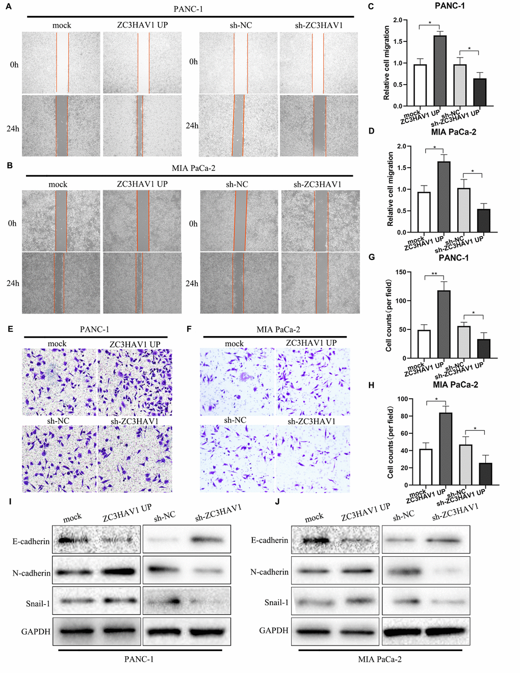 ZC3HAV1 increases the migratory ability in PANC-1 and MIA PaCa-2 cells. (A–D) Migration of cells after transfection was measured by wound-healing assays. (E–H) Cell invasion abilities were settled by transwell assays after transfection. (I, J) Western blot analysis of the EMT-related markers E-cadherin, N-cadherin, and Snail-1 after transfection in PANC-1 and MIA PaCa-2 cells. Data were showed by mean ± SD, *PP