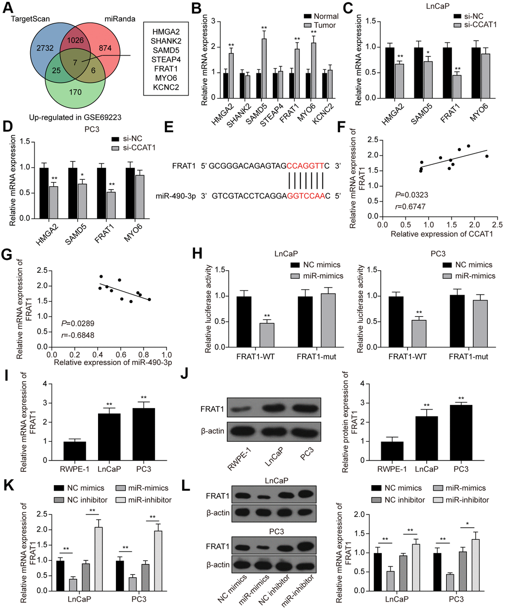 FRAT1 was directly targeted by miR-490-3p. (A) 7 potential target genes of miR-490-3p were screened out. (B) qRT-PCR detection of the 7 potential target genes in PCa tissues. Among them, HMGA2, SAMD5, FRAT1, and MYO6 were greatly up-regulated in PCa tissues compared with adjacent normal tissues. (C, D) Knockdown of CCAT1 greatly down-regulated the expression of HMGA2, SAMD5, and FRAT1. (E) Predicted binding sites between miR-490-3p and FRAT1. (F, G) FRAT1 expression was positively correlated with CCAT1 level and negatively correlated with miR-490-3p level. (H) Dual-luciferase reporter assay detection of the interaction between miR-490-3p and FRAT1 in LnCaP and PC3 cells. (I, J) mRNA and protein expression of FRAT1 in RWPE-1, LnCaP, and PC3 cells. Both FRAT1 mRNA and protein expression were up-regulated in PCa cell lines. (K, L) miR-490-3p overexpression greatly down-regulated the mRNA and protein expression of FRAT1, while down-regulation of miR-490-3p promoted the mRNA and protein expression of FRAT1. *P P 