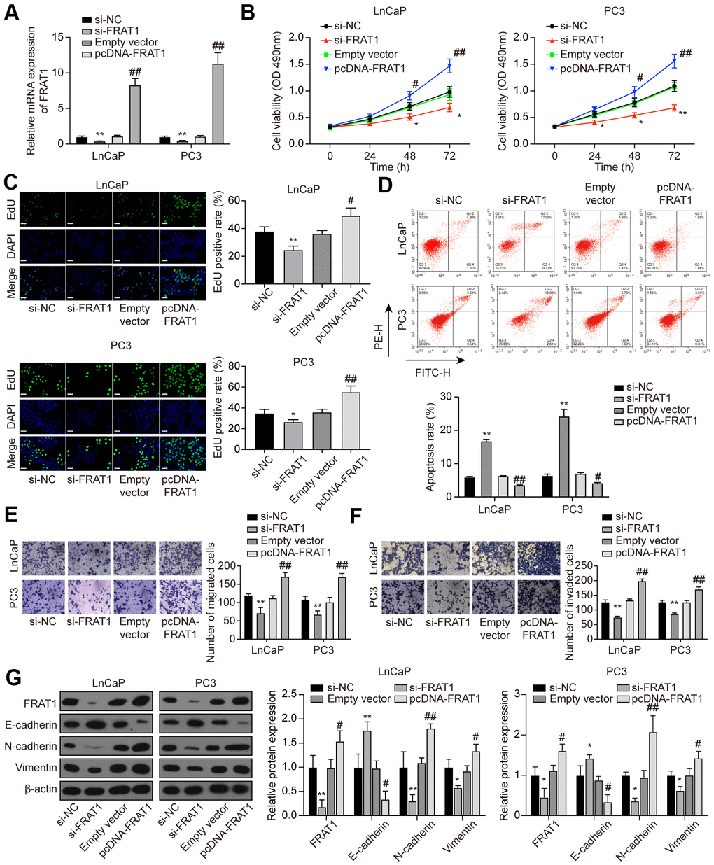 Suppression of FRAT1 inhibited cell proliferation, migration, and invasion in PCa cells. (A) Expression of FRAT1 in LnCaP and PC3 cells transfected with si-FRAT1 or pcDNA-FRAT1. (B) Cell viability of LnCaP and PC3 cells. Cell viability was suppressed in PCa cells treated with si-FRAT1 and promoted in PCa cells with pcDNA-FRAT1. (C) EdU staining results in LnCaP and PC3 cells. si-FRAT1 treatment suppressed cell proliferation while pcDNA-FRAT1 treatment promoted cell proliferation in PCa cells. Scale bar: 50 μm. (D) Cell apoptosis detection of LnCaP and PC3 cells by flow cytometry detection. PCa cells with lower FRAT1 expression had higher apoptosis rate, while PCa cells with higher FRAT1 expression had lower apoptosis rate. (E, F) Cell migration and invasion of LnCaP and PC3 cells in Transwell assays. Down-regulation of FRAT1 inhibited PCa cells migration and invasion, and overexpression of FRAT1 promoted PCa cells migration and invasion. (G) Western blot of EMT-associated protein in each group of PCa cells. E-cadherin expression was up-regulated while N-cadherin and Vimentin expression was suppressed in PCa cells transfected with si-FRAT1. PCa cells transfected with pcDNA-FRAT1 showed the opposite results. *P P P P 