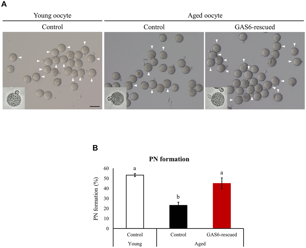 GAS6 restores the Gas6 silencing- and/or maternal age-induced decline in fertility. (A) Microphotographs of PN embryos after in vitro fertilization. Aged oocytes were treated without (control) or with the GAS6 protein (GAS6-rescued) and then fertilized after in vitro culture. White triangles indicate PN formation. Scale bars represent 100 μm. (B) Percentage of oocytes showing PN formation after in vitro fertilization. Experiments were repeated at least three times, and data are presented as the means ± SEM. Different letters indicate significant differences at p