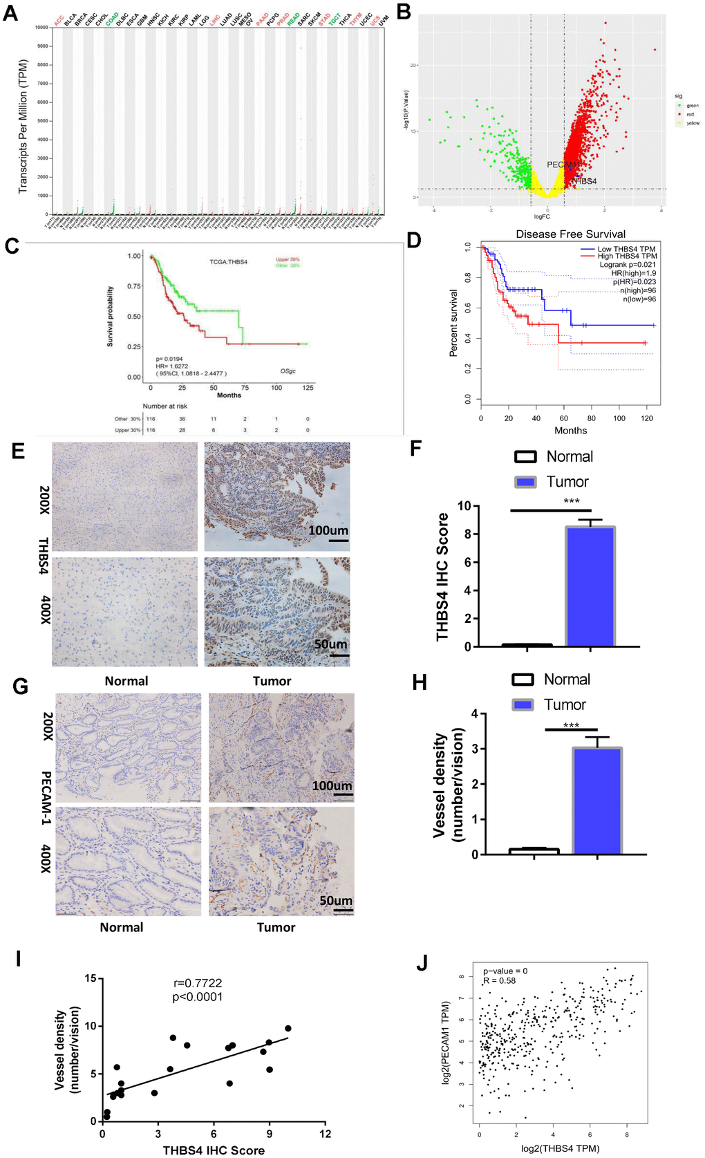 Overexpression of THBS4 is correlated with vessel density in human GC tissues and predicts a poor prognosis. (A) The expression of THBS4 in a pan-cancer dataset. The red and green labels at the top represent high and low expression in certain tumor types, respectively. (B) Volcano plot revealed upregulation of THBS4 mRNA expression in GC compared with normal tissue. (C, D) The overall survival and disease-free survival analyses of THBS4 were plotted for patients with GC in TCGA. (E) Representative IHC staining with THBS4 antibody in GC and adjacent nontumor tissues. n= 5 samples per group. (F) Quantification of E. (G) Representative IHC staining with PECAM1 antibody in GC and adjacent nontumor tissues. n= 5 samples per group. (H) Quantification of G. (I) Correlation analysis of THBS4 and vessel density showed that THBS4 was positively correlated with vessel density in GC. (J) Validation of the positive correlation between THBS4 and PECAM1 in GEPIA.