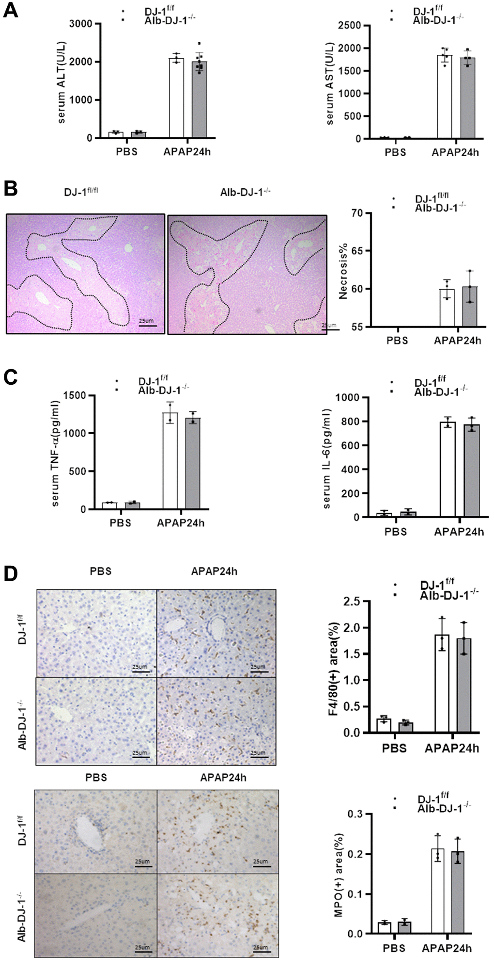 Hepatic DJ-1 deficiency has no protective effect on APAP-induced liver injury. Fasted DJ-1fl/fl and Alb-DJ-1−/− mice were intraperitoneal injected with a single dose of 300mg/kg of APAP. (A) Serum levels of ALT and AST 24h after APAP treatment (n = 4–6). (B) Representative images of hepatic HE staining of DJ-1fl/fl and Alb-DJ-1−/− mice 24 h after APAP challenge (origin magnification ×200). (C) Serum levels of TNF-α and IL-6 24 h after APAP treatment (n = 4–6). (D) Immunohistochemistry of hepatic F4/80 and MPO with APAP treatment. Representative images are shown (origin magnification ×200) (n = 4–6). Data are shown as means ± SD.