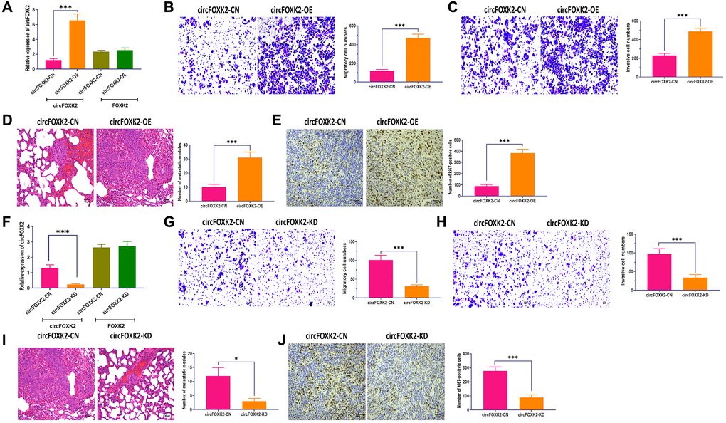 CircFOXK2 is required for BC metastasis. (A) Expressions of circFOXK2 and FOXK2 mRNA in BT-549 cells transfected with circFOXK2-expressing plasmids and the negative control. (B) Migration ability of circFOXK2-overexpressing BT-549 cells. Scale bar: 20 μm. (C) Invasion ability of circFOXK2-overexpressing BT-549 cells. Scale bar: 20 μm. (D) Lung metastasis of mice injected with circFOXK2-overexpressing BT-549 cells through the tail vein, as determined by H&E stain. Scale bar: 50 μm. (E) The expression of Ki67 in lung tissues of mice injected with circFOXK2-overexpressing BT-549 cells through the tail vein, as determined by IHC assay. Scale bar: 40 μm. (F) Expressions of circFOXK2 and FOXK2 mRNA in BT-549 cells transfected with circLONP2-specific anti-sense oligonucleotide (ASO). (G) Migration ability of circFOXK2-Knockdown BT-549 cells. Scale bar: 20 μm. (H) Invasion ability of circFOXK2-Knockdown BT-549 cells. Scale bar: 20 μm. (I) Lung metastasis of mice injected with circFOXK2-Knockdown BT-549 cells through the tail vein, as determined by H&E stain. Scale bar: 50 μm. (J) The expression of Ki67 in lung tissues of mice injected with circFOXK2-Knockdown BT-549 cells through the tail vein, as determined by IHC assay. Scale bar: 40 μm. Data were represented as mean ± SD. Each experimental group had at least three replicates. *p **p ***p 