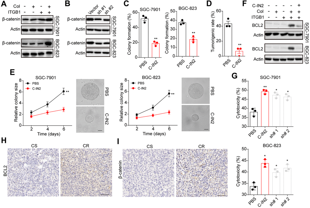 BCL9L mediated gastric progression through downstream β-catenin and BCL2. (A) ITGB1-/+ SGC-7901/BGC-823 cells were sorted and cultured with 3D collagen gel (6 days) or not. The expression of β-catenin and β-actin was examined by western blotting. (B) ITGB1+ SGC-7901/BGC-823 cells were cultured in 3D collagen gels (6 days) and treated with BCL9L shRNA or vector. Then the expression of β-catenin and β-actin was examined by western blotting. (C) ITGB1+ SGC-7901/BGC-823 cells were cultured in 3D collagen gels (6 days) and treated with PBS or C-IN2 (5 μM). Then the 3D colony formation capability was examined. (D) ITGB1+ SGC-7901/BGC-823 cells were cultured in 3D collagen gels (6 days) and treated with PBS or C-IN2 (5 μM). Then the 3D colony formation capability was examined. Then the tumorigenic capability was examined in NOD-SCID mice. (E) ITGB1+ SGC-7901/BGC-823 cells were cultured in 3D collagen gels (6 days) and treated with PBS or C-IN2 (5 μM). Then the colony sizes were examined. The scale bar is 30 μm. (F) ITGB1-/+ SGC-7901/BGC-823 cells were cultured in 3D collagen gel (6 days) and treated with PBS or C-IN2 (5 μM). Then the expression of BCL2 and β-actin was examined by western blotting. (G) ITGB1+ SGC-7901/BGC-823 cells were cultured in 3D collagen gel (6 days) and treated with PBS, C-IN2 (5 μM) or BCL2 shRNA. Then tumor cells were treated with 5-FU (5 μg/ml) and the apoptosis was examined. (H) Immunohistochemical staining of β-catenin in chemo-sensitive (CS) and chemo-resistant (CR) tissues from gastric patients. The scale bar is 100 μm. (I) immunohistochemical staining of BCL2 in chemo-sensitive (CS) and chemo-resistant (CR) tissues from gastric patients. The scale bar is 100 μm. * Indicates P 