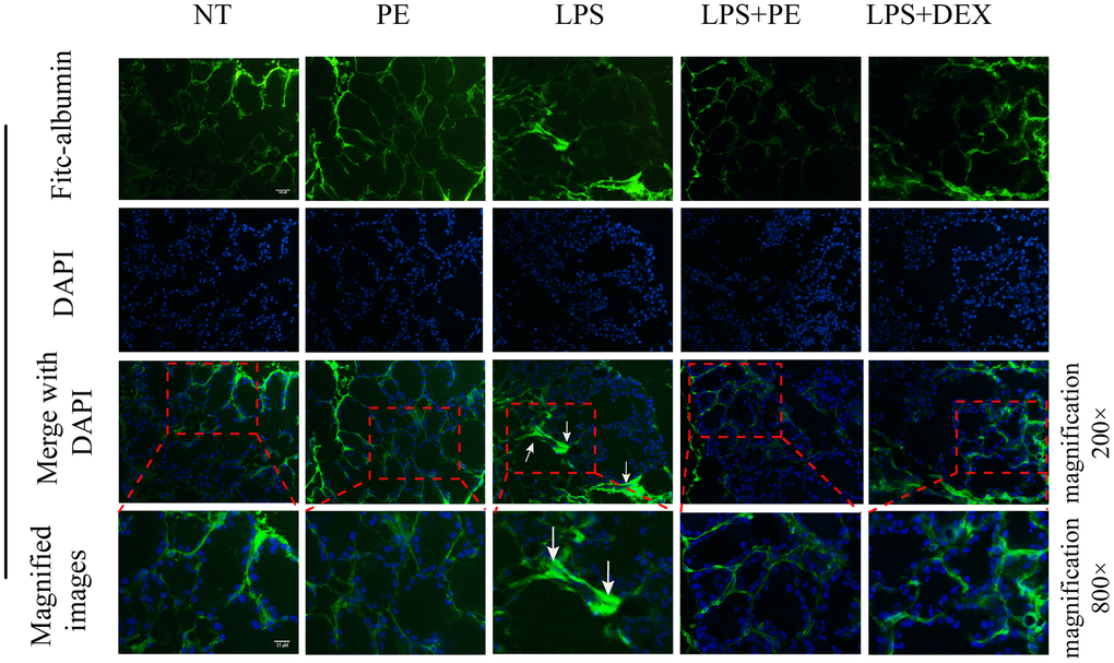 Effect of PE on the integrity of blood-milk barrier in mice with mastitis in vivo. Fresh mice mammary gland was immersed in a 2 mg/mL FITC solution, quickly frozen in liquid nitrogen, and then frozen sections were prepared and obtained to evaluate the damage of the mice blood-milk barrier. Green fluorescence represents albumin fluorescein isothiocyanate conjugate protein province (FITC); blue represents nucleus. The arrows represent the leaking FITC in the damaged acinus and the shrinking acinar. The scale bar was 25 and 100 μM, respectively.