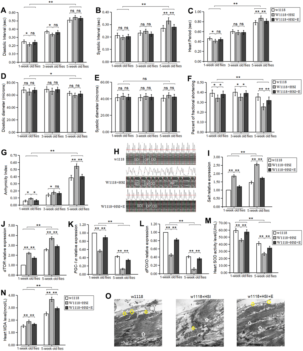 Influence of HSI and LTE on heart. (A) Heart diastolic period. (B) Heart systolic period. (C) Heart period. (D) Diastolic diameter. (E) Systolic diameter. (F) Fractional shortening. (G) Arrhythmia index. (H) Microscopic image of cardiac function from M-mode trace in 5-week-old Drosophila. It can be observed that HSI could increase heart period and arrhythmia, and it could reduce fractional shortening. LTE reduced heart period and arrhythmia, and it could increase fractional shortening. (I) Cardiac salt expression level. (J) Cardiac dTOR expression. (K) Cardiac PGC-1α expression. (L) Cardiac dFOXO expression. (M) Cardiac SOD activity level. (N) Cardiac MDA level. (O) Ultrastructure images of myocardium in 5-week old flies and the white arrows refer to the myofibril in the images, and the yellow arrows refer to mitochondria. Independent-sample t-tests were used to assess differences in 1-week old flies and 5-week old flies in flies. Using a one-way analysis of variance (ANOVA) followed by an LSD test among the group w1118, w1118+HSI, and w1118+HSI+E. Data are represented as means ± SEM. *P