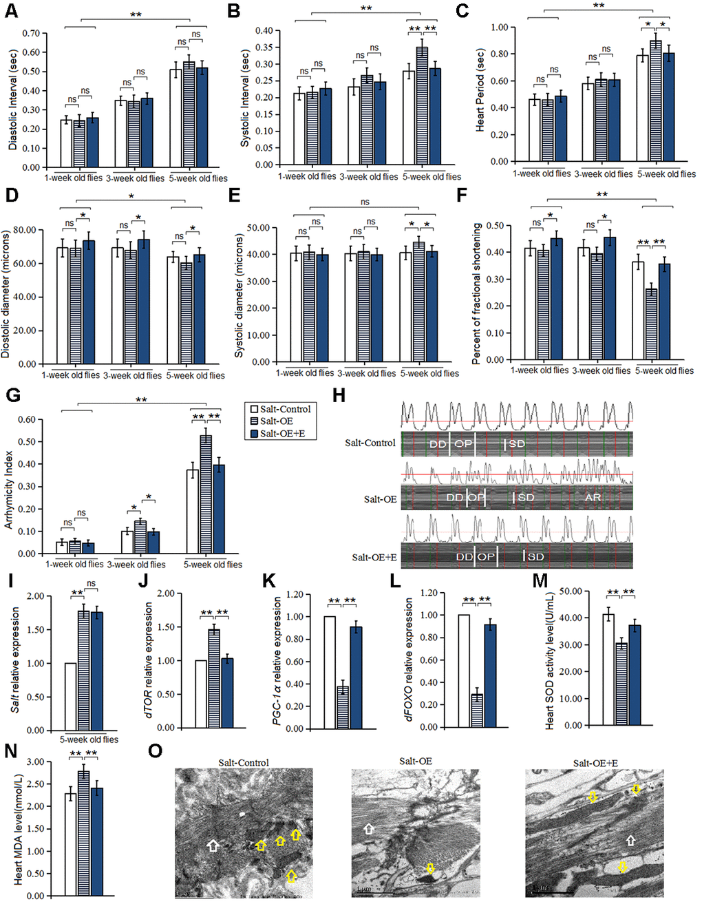 Influence of salt overexpression and LTE on heart. (A) Heart diastolic period. (B) Heart systolic period. (C) Heart period. (D) Diastolic diameter. (E) Systolic diameter. (F) Fractional shortening. (G) Arrhythmia index. (H) Microscopic image of cardiac function from M-mode trace in 5-week-old Drosophila. It can be observed that heart salt gene overexpression could increase heart period and arrhythmia, and it could reduce fractional shortening. LTE could reduce heart period and arrhythmia, and it could increase fractional shortening in heart salt gene overexpression flies. (I) Cardiac salt expression level. (J) Cardiac dTOR expression. (K) Cardiac PGC-1α expression. (L) Cardiac dFOXO expression. (M) Cardiac SOD activity level. (N) Cardiac MDA level. (O) Ultrastructure images of myocardium in 5-week old flies and the white arrows refer to the myofibril in the images, and the yellow arrows refer to mitochondria. Independent-sample t-tests were used to assess differences in 1-week old flies and 5-week old flies in flies. Using a one-way analysis of variance (ANOVA) followed by an LSD test among the group Salt-control, Salt-OE, and Salt-OE+E. Data are represented as means ± SEM. *P