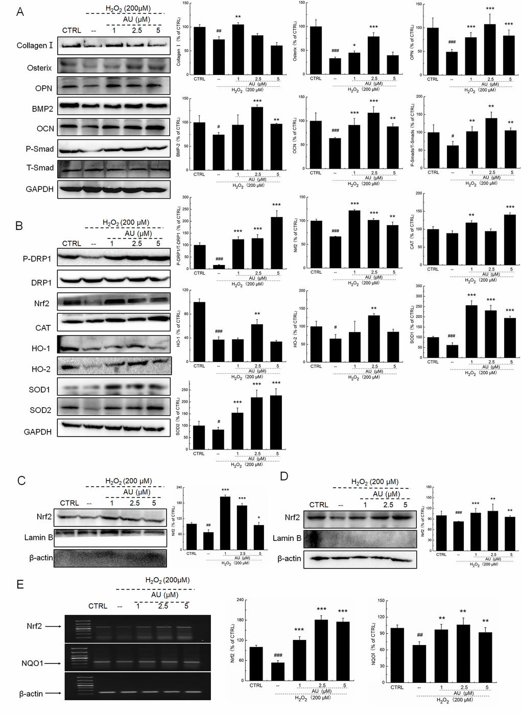 AU protected the H2O2-caused MG63 cells apoptosis via regulation the Nrf2/HO-1 signaling. (A) AU up-regulated the expression levels of osteoblast differentiation related proteins including Collagen I, Osterix, OPN, BMP2, OCN and P-Smad in MG63 cells exposed to H2O2. (B) AU increased the expression levels of proteins within the Nrf2/HO-1 signaling including P-DPR1, Nrf2, CAT, HO-1, HO-2, SOD-1 and SOD-2 in MG63 cells exposed to H2O2. AU enhanced the expression levels of Nrf2 in both (C) nucleus and (D) cytoplasm of MG63 cells exposed to H2O2. The quantification data of proteins were normalized by corresponding GAPDH, Lamin B, β-actin or total proteins, respectively (n=4). (E) AU increased the mRNA levels of Nrf2 and NQO-1 in MG63 cells exposed to H2O2. Marker size from top to bottom: 1000 bp, 700 bp, 500 bp, 400 bp, 300 bp, 200 bp and 100 bp. The data on quantified mRNA expression were normalized to the levels of β-actin (n=4). Data are expressed as mean ± S.D. and analyzed using a one-way ANOVA. # PPPvs. control cells, *PPPvs. H2O2-exposed cells.