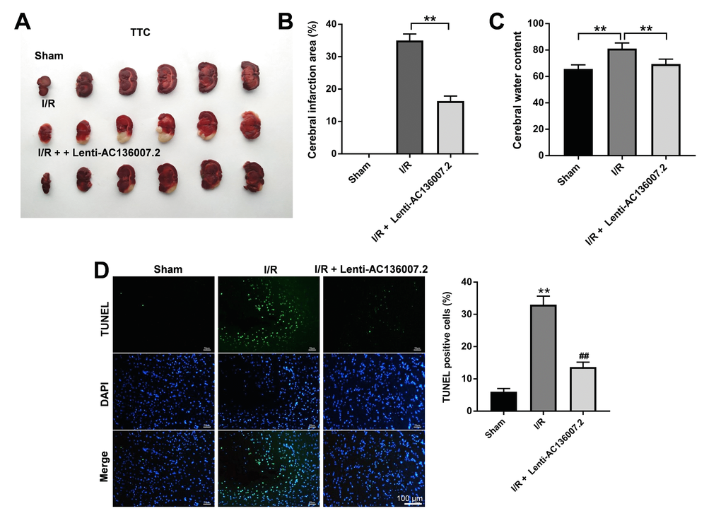 AC136007.2 reduces cerebral infarction, brain edema, and brain cell death after MCAO in rats. (A) Detection of brain infarction area by TTC staining. (B) TTC-based quantification of cerebral infarction (as percentage of the whole hemisphere). **pC) Cerebral water content measurements. **pD) TUNEL staining assessment of apoptosis in brain sections. **p## p