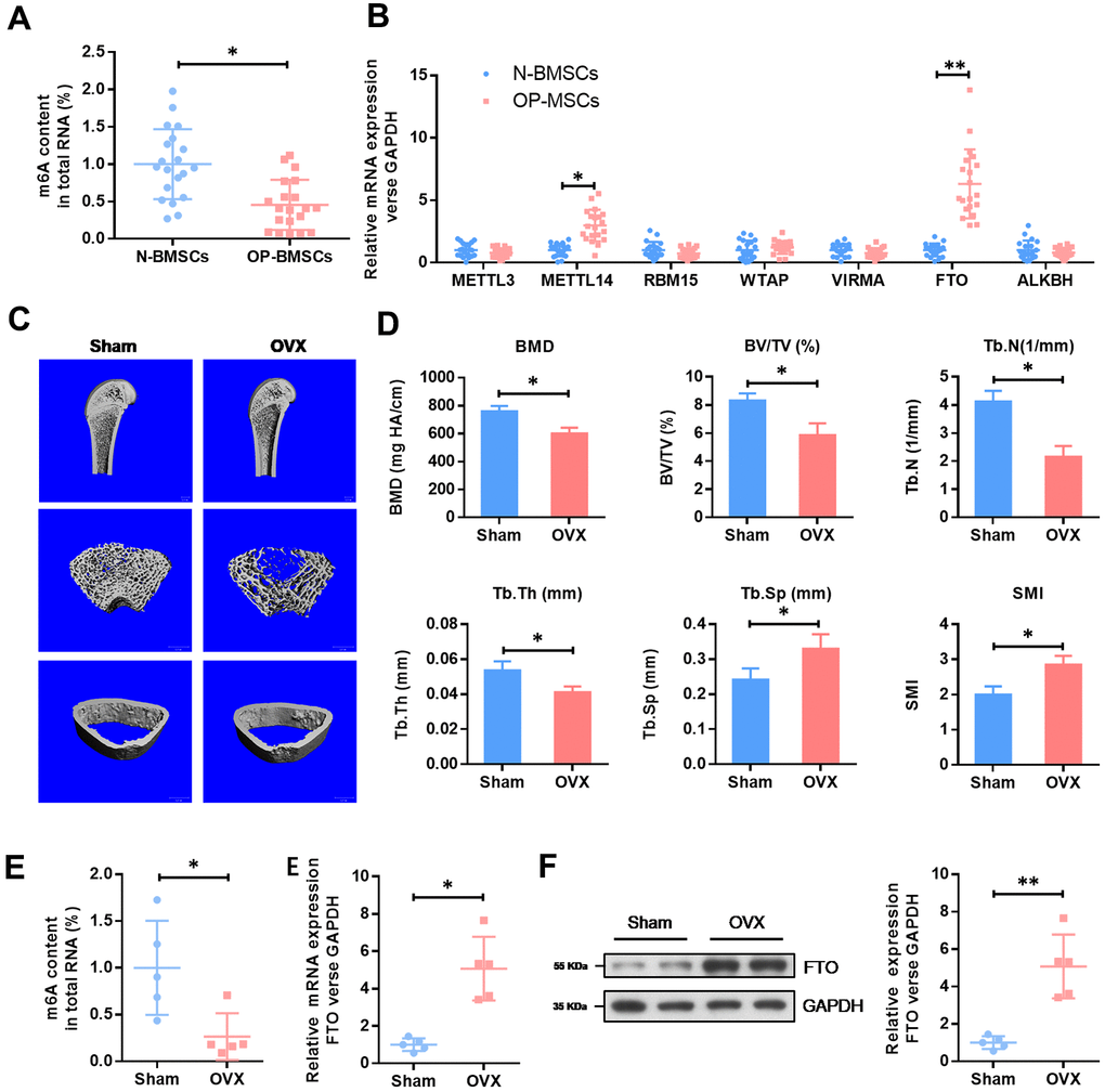 The expression level of methyltransferase FTO is elevated in BMSCs from OP patients and OVX mouse. (A) The methylated RNA (m6A) level in 20 cases of normal BMSCs from bone fracture patients (N-BMSCs) and 20 cases of BMSCs from OP patients (OP-BMSCs). *PB) The mRNA level of critical methyltransferase (METTL3, METTL14, RBM15, WTAP and VIRMA) and demethylases (FTO and ALKBH1) in 20 cases of normal BMSCs from bone fracture patients (N-BMSCs) and 20 cases of BMSCs from OP patients (OP-BMSCs) were analyzed by qRT-PCR. *PPC) Representative images of μCT reconstructive images of tibial plateau in sham and OVX groups. (D) 3D structural parameters-BMD, BV/TV, Tb.N, Tb.Sp, Tb.Th and SMI-of tibial plateau by μCT in sham and OVX groups. (E) The methylated RNA (m6A) level and FTO expression in BMSCs from sham and OVX mouse. *PF) The protein level of FTO in BMSCs from sham and OVX mouse were analyzed by western blot. **P