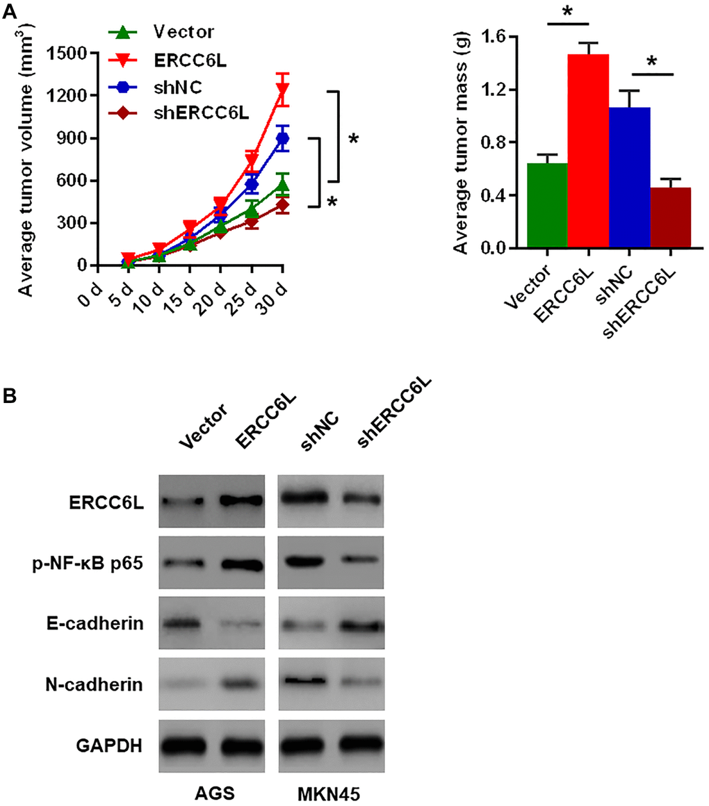 The effects of ERCC6L overexpression or knockdown on GC cells growth in vivo. (A) Representative images of the dissected xenograft tumors. Tumor volume was measured every 5 days. Tumors were weighed at the endpoint (30 days). (B) Western blot analysis of the levels of ERCC6L, p-NF-κB p65, E-cadherin and N-cadherin in the dissected xenograft tumors. (n = 6, each group). *P 