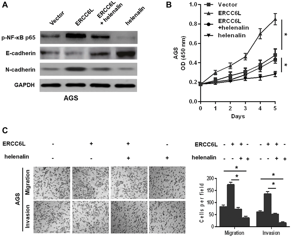 NF-κB signal involved in ERCC6L-facilitated GC cell EMT, growth, migration, and invasion. (A) Western blot analysis of the levels of p-NF-κB p65, E-cadherin and N-cadherin in modified AGS cells treated with helenalin (15 μM, NF-κB signaling inhibitor). (B) Determination of cell proliferation ability followed by the treatment with helenalin by CCK-8 assay. (C) Determination of cell migration and invasion abilities followed by the treatment with helenalin by transwell assay. *P 