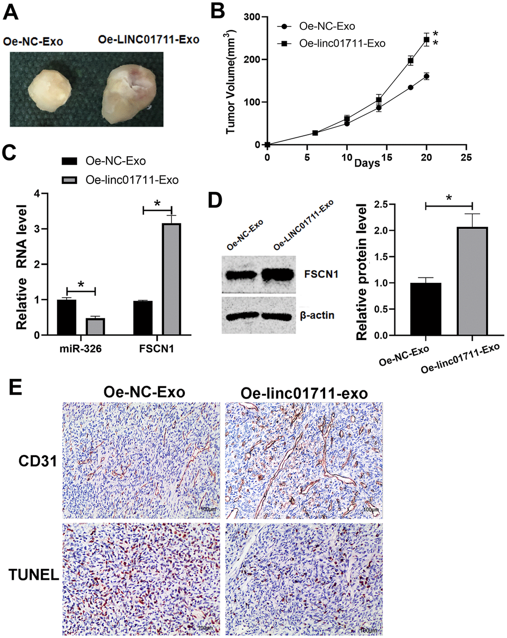 LINC01711-Exo promoted tumor growth in vivo. (A) Representative tumor images. (B) Tumor volume growth curve. n=5. (C) The expression of miR-326 and FSCN1 was detected by RT-qPCR. n=6. (D) The FSCN1 protein level was verified by Western blot. n=3. (E) The apoptosis and angiogenesis of tumor tissue section as detected by TUNEL assay and CD31 immunostaining, respectively. Representative images were shown. * p p 