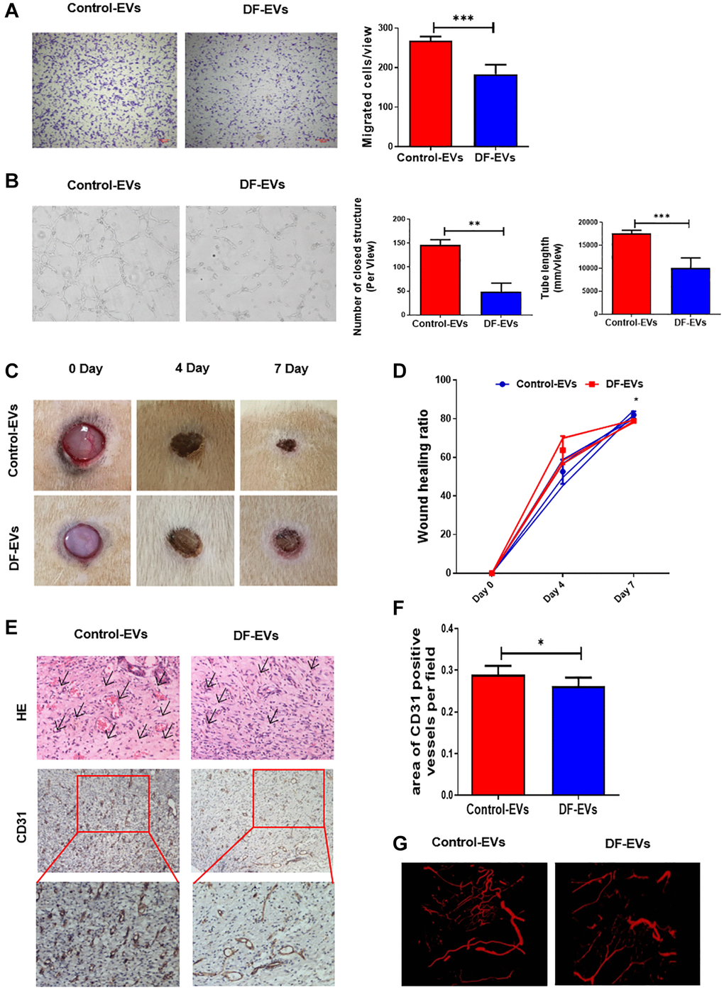 DF-EVs inhibited HUVEC angiogenesis in vitro and in vivo. (A) Transwell assay of HUVECs treated with 5 μg/ml DF-EVs or 5 μg/ml Control-EVs. Scale bar: 100 μm. (B) In vitro tube formation assay of HUVECs treated with 5 μg/ml DF-EVs or 5 μg/ml Control-EVs. (C, D) Representative images of cutaneous wounds with 200 μg Control-EVs and 200 μg DF-EVs treatment at day 0, 4 and 7 post-wounding. (E, F) HE and CD31 staining of wound section with different treatments at day 7 post-wounding. (G) Microangiography analysis of local wound treated with DF-EVs or Control-EVs. *P ***P 