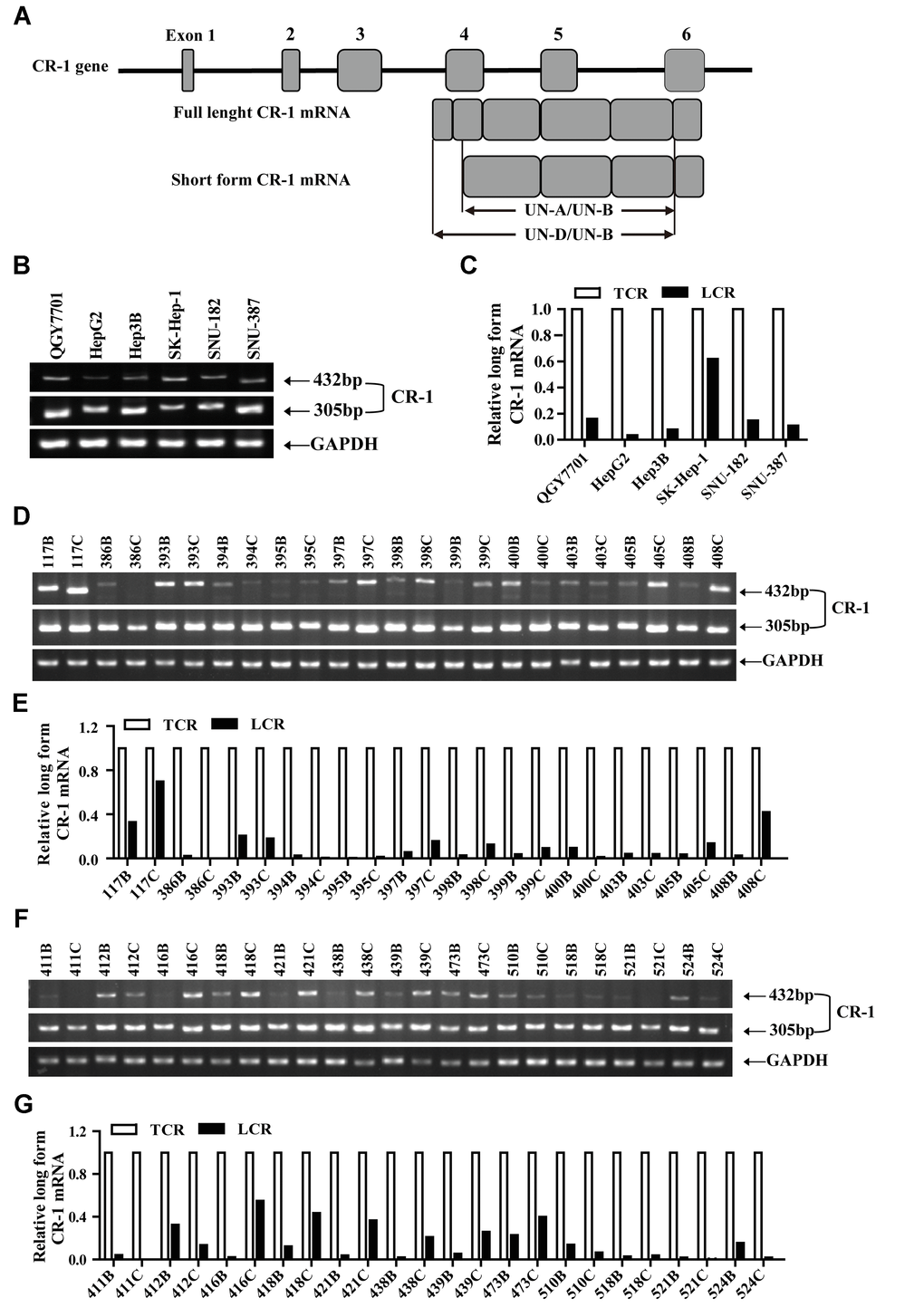 The short form Cripto-1 (CR-1) mRNA is predominantly expressed in HCC cell lines and tissues. (A) Diagrammatic representation shows structure of the CR-1 gene and mRNAs (full-length and short-length forms). UN-D/UN-B: full-length CR-1 (FL-CR1) transcript specific primer set yields 432 bp PCR product; UN-A/UN-B: total CR-1 transcript specific primer set yields 305 bp PCR product. (B–C) RT-PCR analysis shows levels of FL-CR-1 transcript relative to total CR-1 (TCR) transcript levels in human HCC cell lines, QGY7701, Hep3B, HepG2, SK-Hep-1, SNU-387 and SNU-182. GAPDH was used as internal control. (D–G) RT-PCR analysis shows levels of FL-CR-1 transcript relative to total CR-1 transcript in human HCC (T/C) and their corresponding adjacent non-tumor liver tissues (N/B).