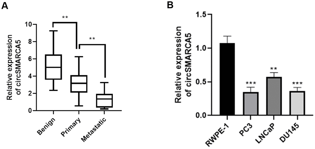 circSMARCA5 expression in prostate tumors. (A) The circSMARCA5 expression pattern in prostate cancer samples and benign controls was determined by qRT-PCR. (B) circSMARCA5 levels were measured in RWPE-1, DU145, LNCaP, and PC3 cells. *, **, *** represent p ≤ 0.05, p ≤ 0.01, p ≤ 0.001, respectively. Assays were performed at least three times.