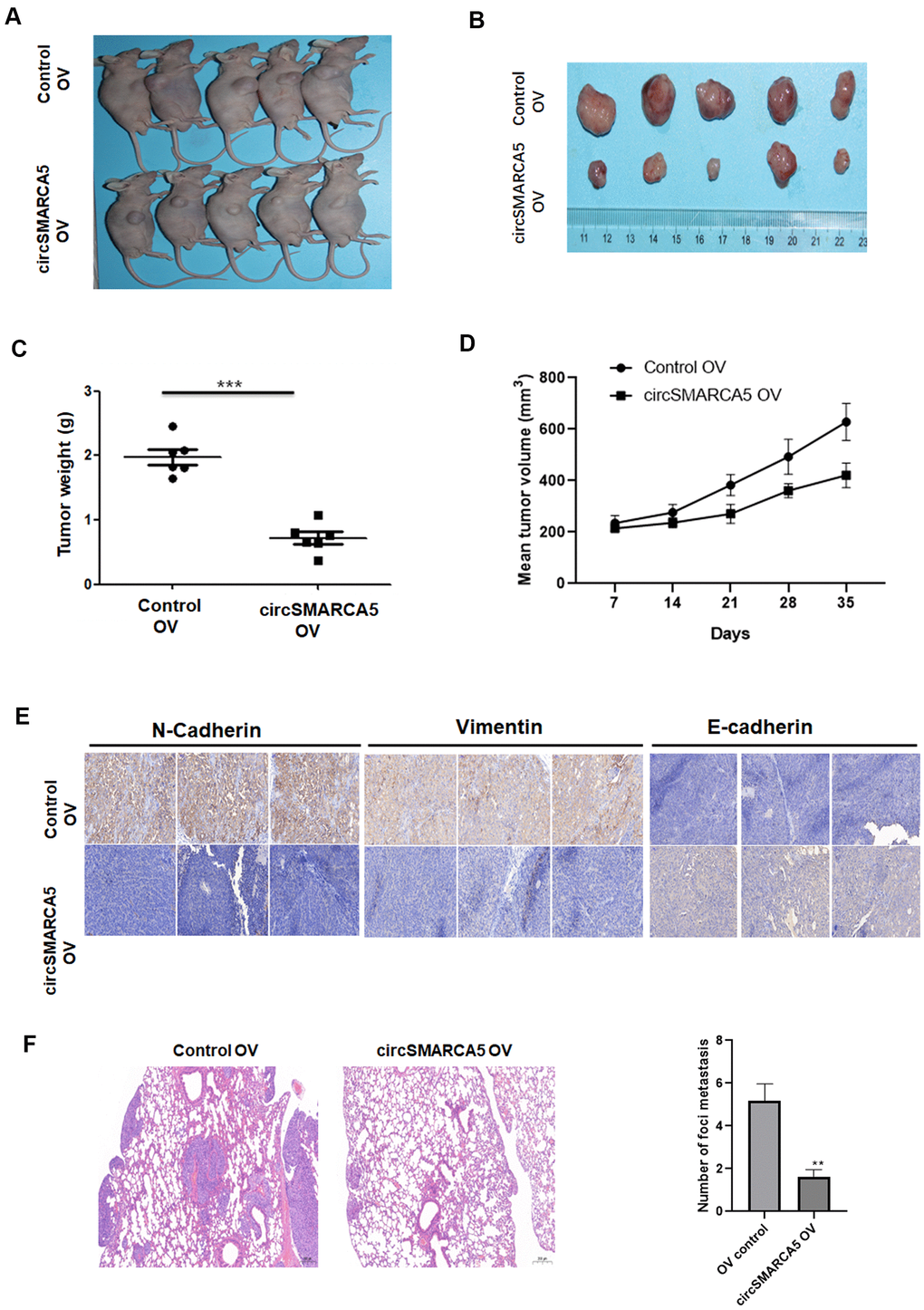 circSMARCA5 suppresses tumor proliferative and invasive potential in vivo. Wild-type and circSMARCA5-overexpressed DU145 cells were injected into nude recipient mice. Every week, information about tumor size was collected. The tumor tissues were removed and the weight was determined four weeks after injection. Representative mice and resected tumors images (A, B). (C, D) Tumor weight and volume. (E) IHC staining of EMT markers, including E-cadherin, vimentin, and N-cadherin. Magnification ×20. (F) H&E staining and lung microscopic nodules quantification of each group. Magnification ×20. *, **, *** represent p ≤ 0.05, p ≤ 0.01, p ≤ 0.001, respectively.