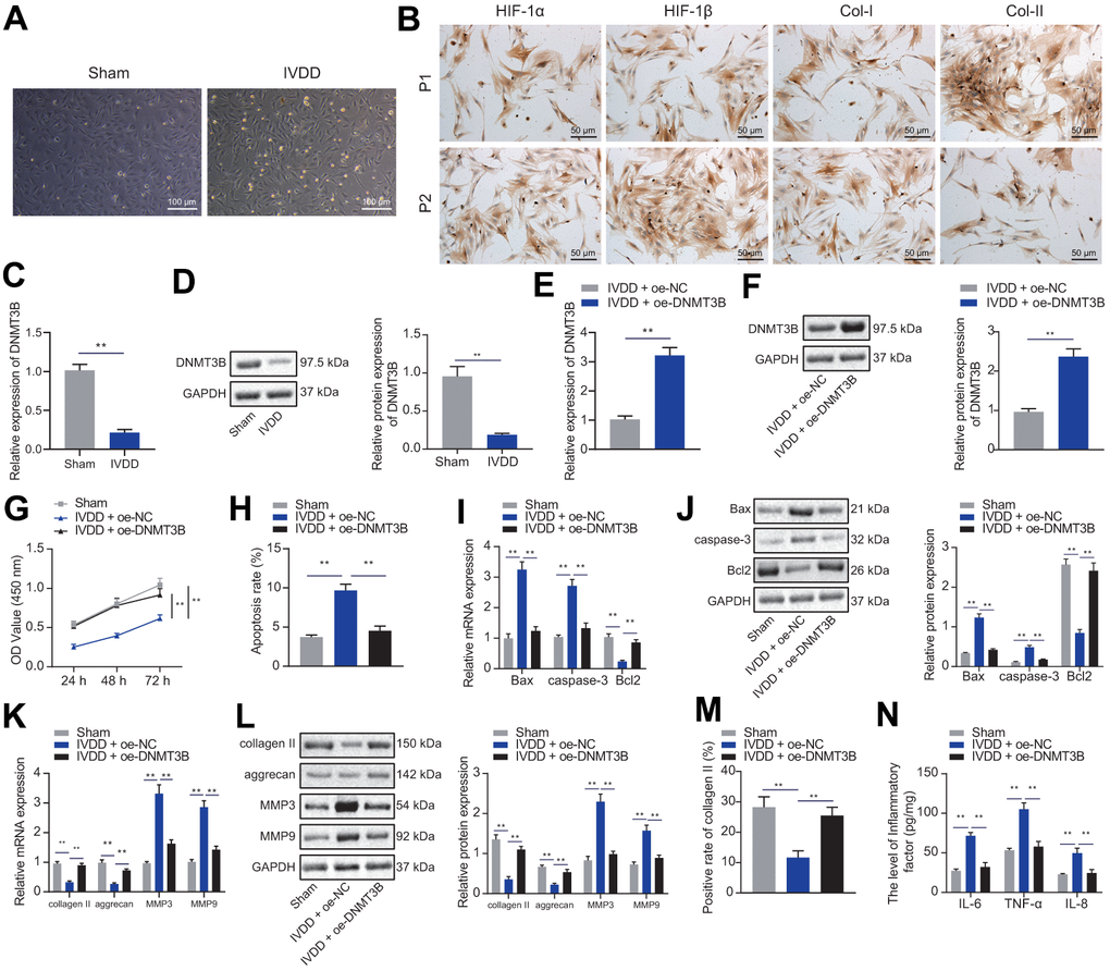 DNMT3B promoted NP cell proliferation and ECM synthesis. (A) Representative images of the morphology of isolated NP cells under an optical microscope. (Scale bar, 100 μm). (B) Immunocytochemical staining showing the expression of HIF-1α, HIF-1β, collagen I, collagen II in primary and second generation of NP cells from IVDD rats (scale bar, 50 μm; magnification 200 ×). (C) The expression of DNMT3B in NP cells from Sham or IVDD rats was detected by qRT-PCR. (D) Western blot showing the expression of DNMT3B in NP cells from Sham or IVDD rats. (E) The expression of DNMT3B in NP cells after 24 hours of transfection of oe-DNMT3B was detected by qRT-PCR. (F) The expression of DNMT3B in NP cells after 48 hours of transfection of oe-DNMT3B was detected by Western blot. (G) The proliferation of NP cells at 24, 48, and 72 hours, after 24 hours of transfection of oe-DNMT3B was detected by CCK-8. (H) The apoptosis of NP cells after 48 hours of treatment with oe-DNMT3B was detected by flow cytometry. (I) The expression of apoptosis-related factors Bax, Bcl-2, and caspase-3 in NP cells after 24 hours of treatment with oe-DNMT3B was detected by qRT-PCR. (J) The expression of apoptosis-related factors Bax, Bcl-2, and caspase-3 in NP cells after 48 h ours of transfection with oe-DNMT3B was detected by Western blot. (K) The expression of collagen II, aggrecan, MMP3, and MMP9 in NP cells after 24 hours of transfection with oe-DNMT3B was detected by RT-qPCR. (L) The expression of collagen II, aggrecan, MMP3, and MMP9 in NP cells after 48 hours of transfection with oe-DNMT3B was detected by Western blot. (M) Immunofluorescence staining showing the protein content of collagen II in NP cells after 48 hours of treatment with oe-DNMT3B. (N) The levels of inflammatory factors IL-6, TNF-α, IL-8 in NP cells after 24 hours of treatment with oe-DNMT3B were detected by ELISA. Measurement data are expressed as the mean ± standard deviation (n = 3) and analyzed using independent sample t-tests between two groups or using two-way ANOVA between groups at different time points. **, p 