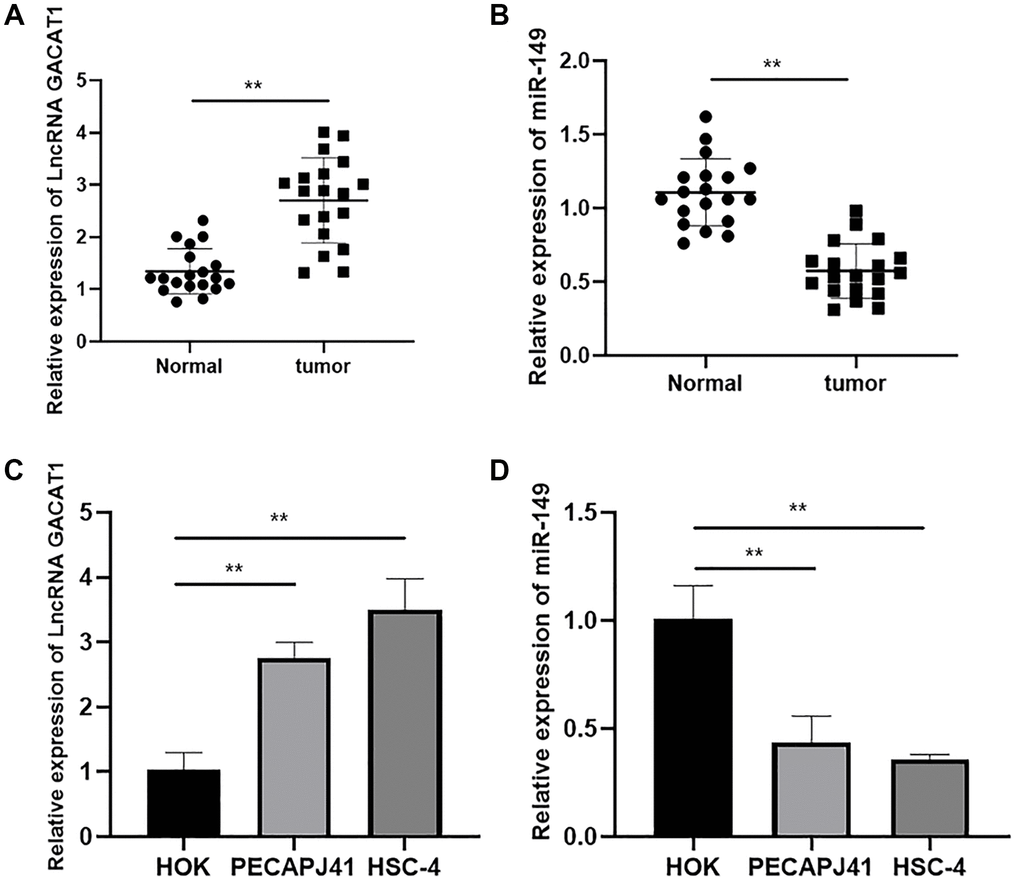 Expression of lncRNA GACAT1 and miR-149 in cancer tissues and cell lines of patients with OSCC. (A) Relative expressions of lncRNA GACAT1 in OSCC tissues; (B) Relative expressions of miR-149 in OSCC tissues; (C) Relative expressions of lncRNA GACAT1 in OSCC cell lines; (D) Relative expressions of miR-149 in OSCC cell lines. **p 