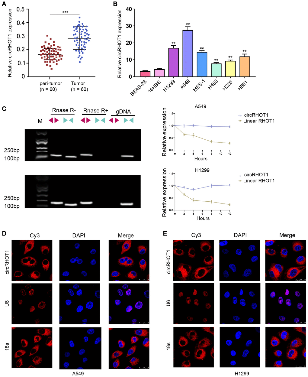 CircRHOT1 is enhanced in clinical NSCLC samples and NSCLC cell lines. (A) The expression of circRHOT1 was analyzed by qPCR in clinical NSCLC tissues (n = 60) and peri-tumor tissues (n = 60). (B) The expression of circRHOT1 was measured by qPCR in the indicated cells. (C) The back-spliced and canonical forms of RHOT1 expression was measured by agarose gel electrophoresis assays and PCR in HCT-116 and HT-29 cells in the presence or absence of RNase R supplementation. (D and E) The localization of circRHOT1 was determined by FISH analysis and 18s and U6 were the controls. mean ± SD, **P 