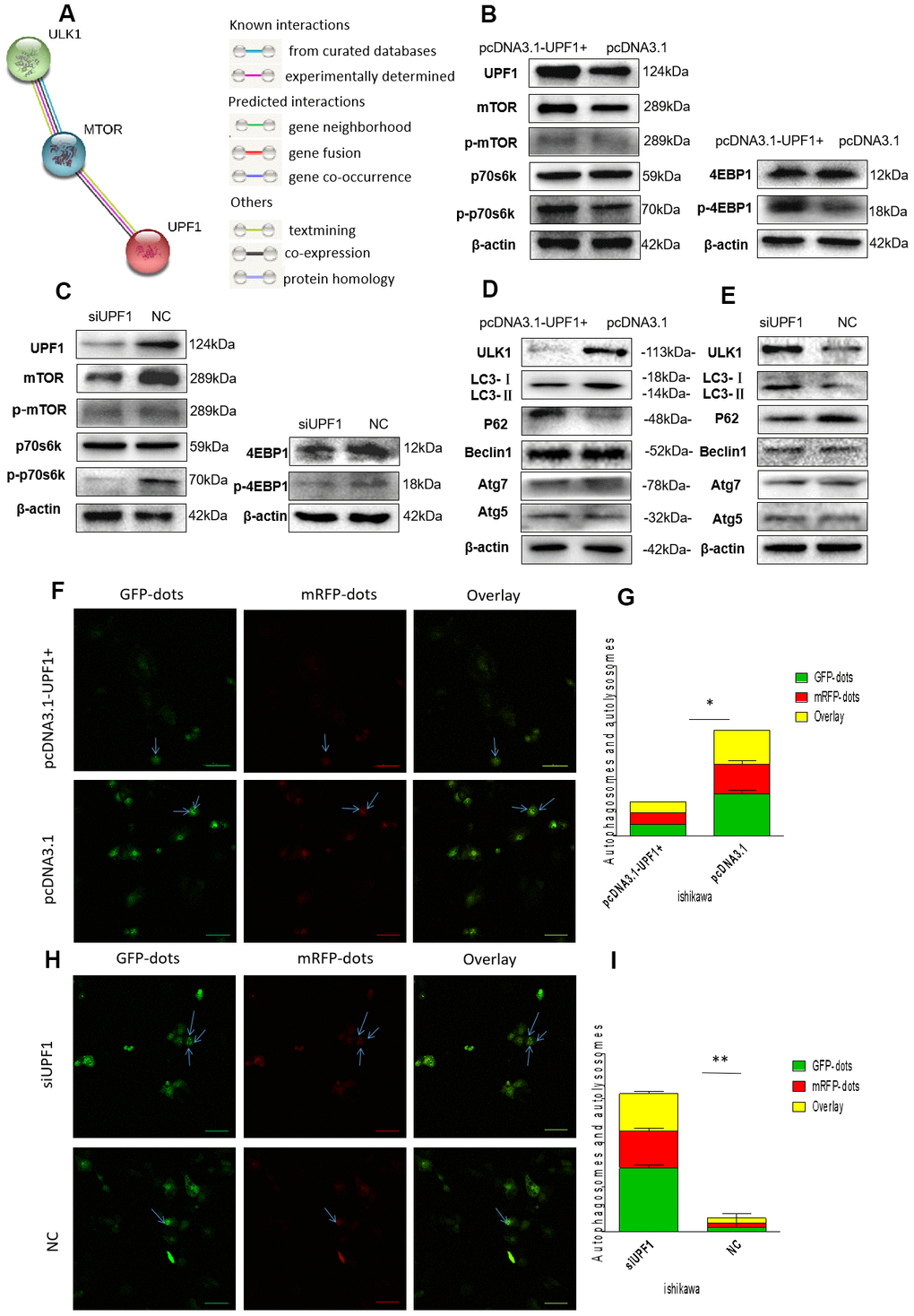 mTOR signaling pathway and autophagy related proteins detection. (A) Bioinformatics prediction (http://www.string-db.org):mTOR and UPF1 maybe co-expression and interaction. However, mTOR and ULK1 show that both of its relationship have verified. (B, C) Transfected with pcDNA3.1-UPF1+ and pcDNA3.1 or siUPF1 and NC in Ishikawa showed that UPF1 could affect mTOR and downstream’s proteins. (D, E) Overexpressed UPF1 or downregulated UPF1 could inhibit or promote autophagy. LC3I/II and p62 showed autophagy weakened or increased. (F–I) The immunofluorescence assays were performed in EEC cells that were transfected with mRFP-GFP-LC3 lentiviral in two different groups. The numbers of GFP and mRFP dots were determined by fluorescent puncta in three high-power fields. The statistical significance between different groups. Data was represented as the mean +/- SEM.*P