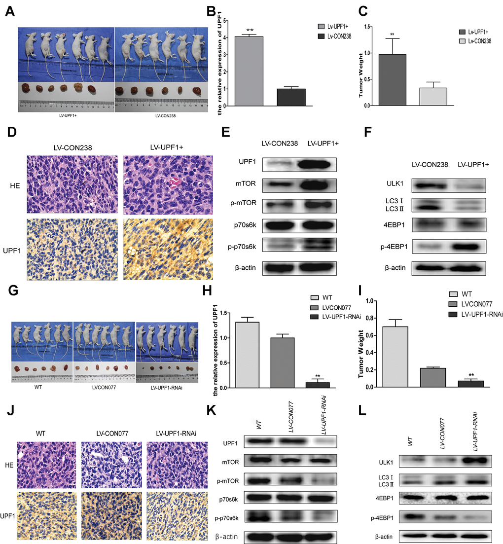 UPF1 influenced tumor growth, mTOR signal pathway and autophagy in vivo. (A, G) Photographs showing tumors that Lentivirus transfected with UPF1 stable expressed Ishikawa cell line (LV-UPF1+) and the control (LV-CON238), and that Lentivirus transfected with interfered UPF1 expressed Ishikawa cell line(LV-UPF1-RNAi), the control (LV-CON077) and wild Type group (WT). (B, H) qRT-PCR detected the relative expression of UPF1 in stable cell line. (C, I) The means tumor weights in nude mice were significant compared with the control group (**PD, J) H&E-stained slides (NIKON,400X) and IHC showed expression of UPF1 in tumors. (E, F, K, L) The mTOR related proteins’ and autophagy related proteins’ expression in tumors.