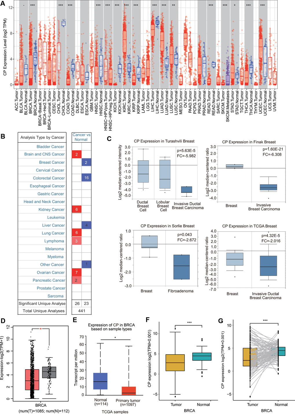 Ceruloplasmin transcript levels in diverse cancer types. (A) Differential ceruloplasmin mRNA expression between tumor tissues and normal tissues in the TIMER database. (B) Significant upregulation (red) and downregulation (blue) of ceruloplasmin mRNA in cancer tissues compared with normal tissues. (C) Box plots demonstrating ceruloplasmin expression in the Turashvili breast, Finak breast, Sorlie breast and TCGA breast datasets. (D, E) The mRNA levels of ceruloplasmin were lower in BRCA than in normal tissues in the GEPIA2 and UALCAN databases. (F) Ceruloplasmin expression levels in BRCA samples obtained from TCGA. (G) Ceruloplasmin expression in 112 matched BRCA and normal breast tissues in the TCGA database was examined. *