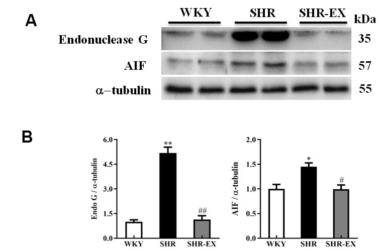 The endonuclease G (EndoG) and apoptosis-inducing factor (AIF) caspase-independent apoptotic pathway in a normotensive Wistar Kyoto (WKY) group, a spontaneously early aged hypertensive (SHR) group and a hypertension with 12 weeks exercise training (SHR-EX) group. (A) The 3 representative protein levels of AIF and EndoG extracted from the cerebral cortex of excised brain in WKY, SHR, and SHR-EX groups were measured by Wester blotting analysis. The α-tubulin was used as an internal control. (B) Bars represent the relative fold changes of protein quantification relative to the control group in EndoG and AIF proteins on α-tubulin and mean values ± SD (n=6 in each group). *: pppp