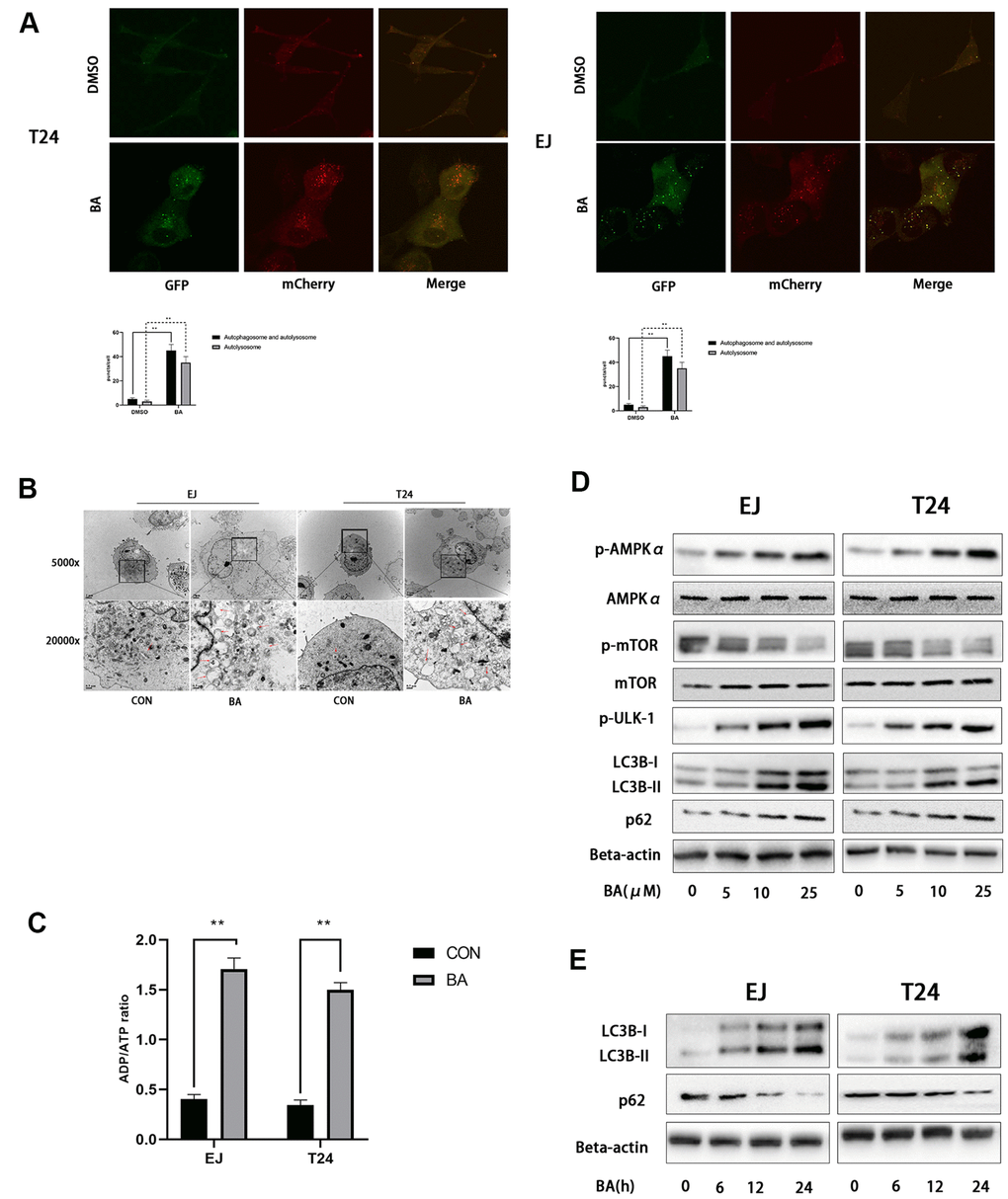 BA induces autophagy in human bladder cancer cells. (A) Confocal fluorescence microscopy of EJ and T24 cells transfected with mCherry-GFP-LC3B lentivirus and exposed to 25 μM BA for 24 h. (B) Transmission electron microscopy (magnification: 5000× and 20,000×) images of EJ and T24 cells exposed to 25 μM BA for 24 h. Arrows indicate autophagic vesicles. (C) Luminescent determination of ADP/ATP ratio in EJ and T24 cells exposed to DMSO (control) or BA for 24 h. (D, E) Western blot analysis of changes in AMPK-mTOR-ULK1 phosphorylation status and p62 and LC3B-II expression upon treatment with the specified BA doses. *pp