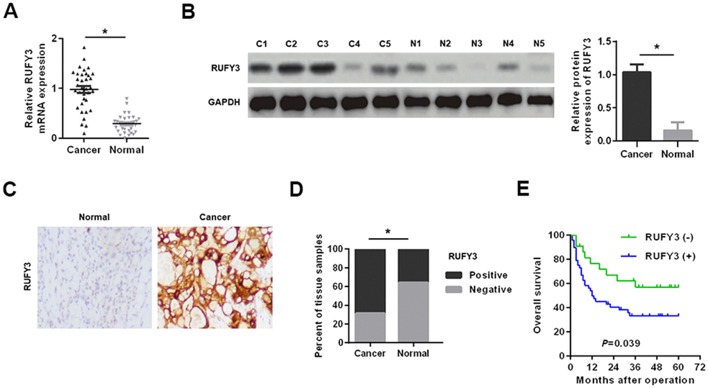 Expression levels of RUFY3 in HCC tissues. (A) Detection of RUFY3 mRNA expression in HCC tissues and adjacent normal tissues by qRT-PCR. (B) Detection of RUFY3 protein expression in HCC cancer tissues (C) and matched normal tissues (N) by western blot analysis. (C) Detection of RUFY3 expression in HCC tissues and matched normal tissues by IHC analysis. (D) Quantitative analysis of RUFY3 expression in HCC tissues and adjacent normal tissues according to IHC staining scores. (E) Kaplan-Meier analysis of overall survival for HCC patients with different levels of RUFY3 expression. *P