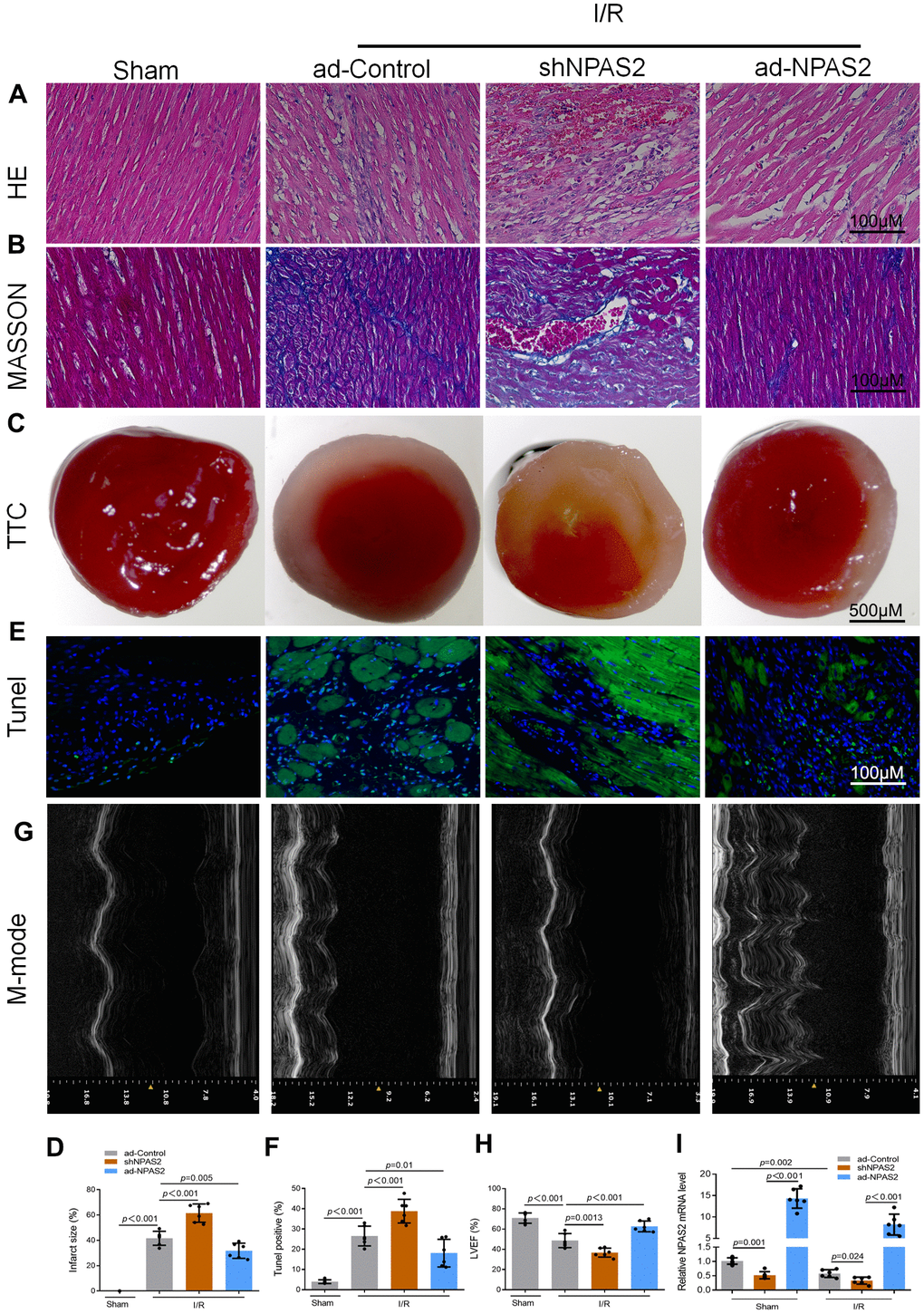 Overexpression of NPAS2 ameliorated rats ischaemia/reperfusion injury in vivo. (A, B) Typical images of H&E and Masson staining of myocardial tissue segments. (C, D) Typical images of TTC of myocardial tissue segments. The infarct size was measured and calculated as a percentage of the total area. (E, F) Typical images of Tunnel of myocardial tissue segments. The relative percentages of apoptotic cells were calculated. (G, H) Typical echocardiographic images of M-mode and LVEF. (I) The mRNA level of NPAS2 in rat myocardial tissue was determined by qRT-PCR. Data are expressed as mean ± SEM (n = 6).