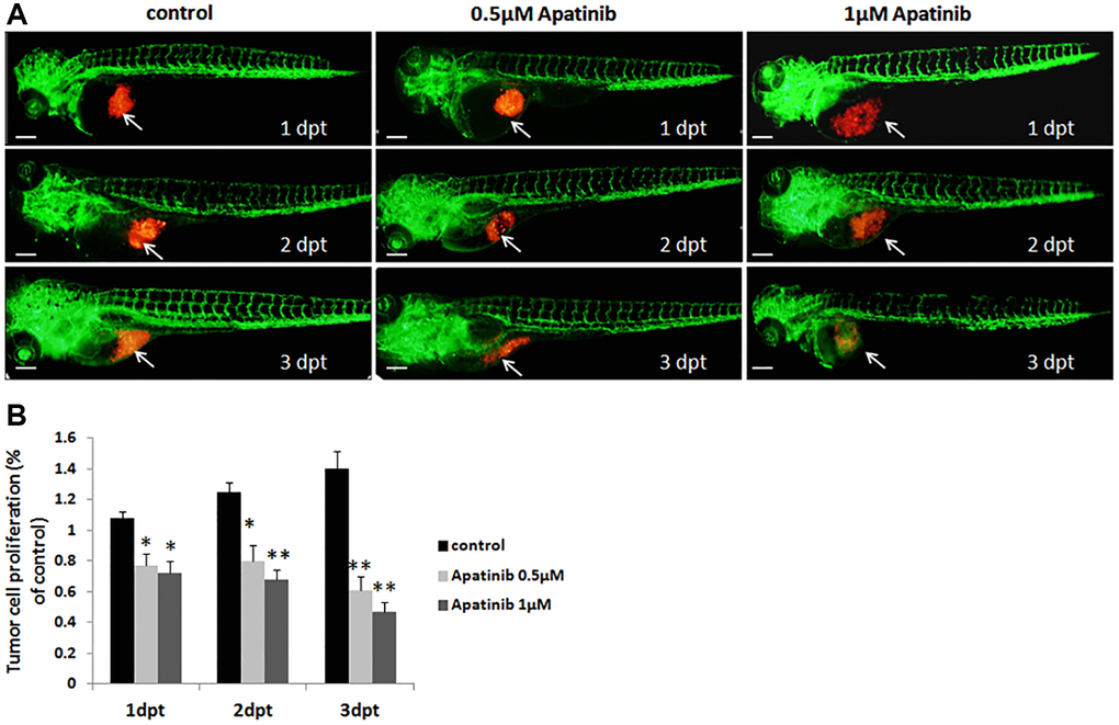 Proliferation of zebrafish xenograft model inhibited by apatinib treatment. (A) Fluorescence image of tumor size in zebrafish induced by MGC-803 with/without apatinib treatment at 1, 2 and 3 dpt. Scale bar: 200 μm. (B) Quantitative analysis of the length of MGC-803 cells proliferation in zebrafish with/without apatinib treatment. Dpt: days post treatment.