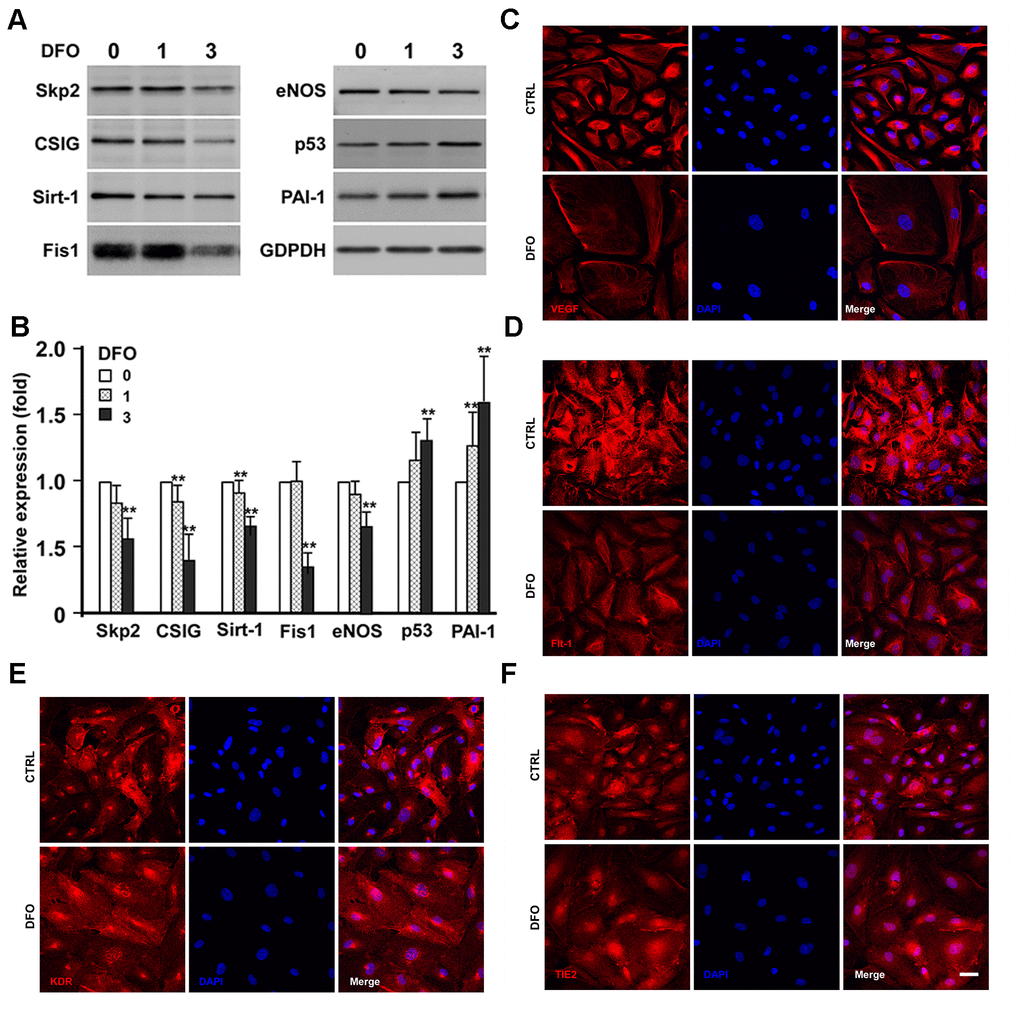 Effects of DFO on the expression of senescence-related proteins and angiogenic factors. (A) EPCs were treated with the indicated concentration (μM) of DFO for four days. Whole-cell lysates were harvested for electrophoresis, and Western blotting was performed with the indicated antibodies. (B) Quantification of relative senescence-related protein levels, normalized to GAPDH. Values are the mean ± standard deviation of triplicate assays from three independent experiments. ** P C–F) Images are cells treated without (CTRL) and with DFO on the expression of VEGF, Flt-1, KDR and TIE2, respectively. Young EPCs were treated with 3 μM DFO for four days, and then were harvested for staining with the indicated antibodies. Scale bar, 50 μm.